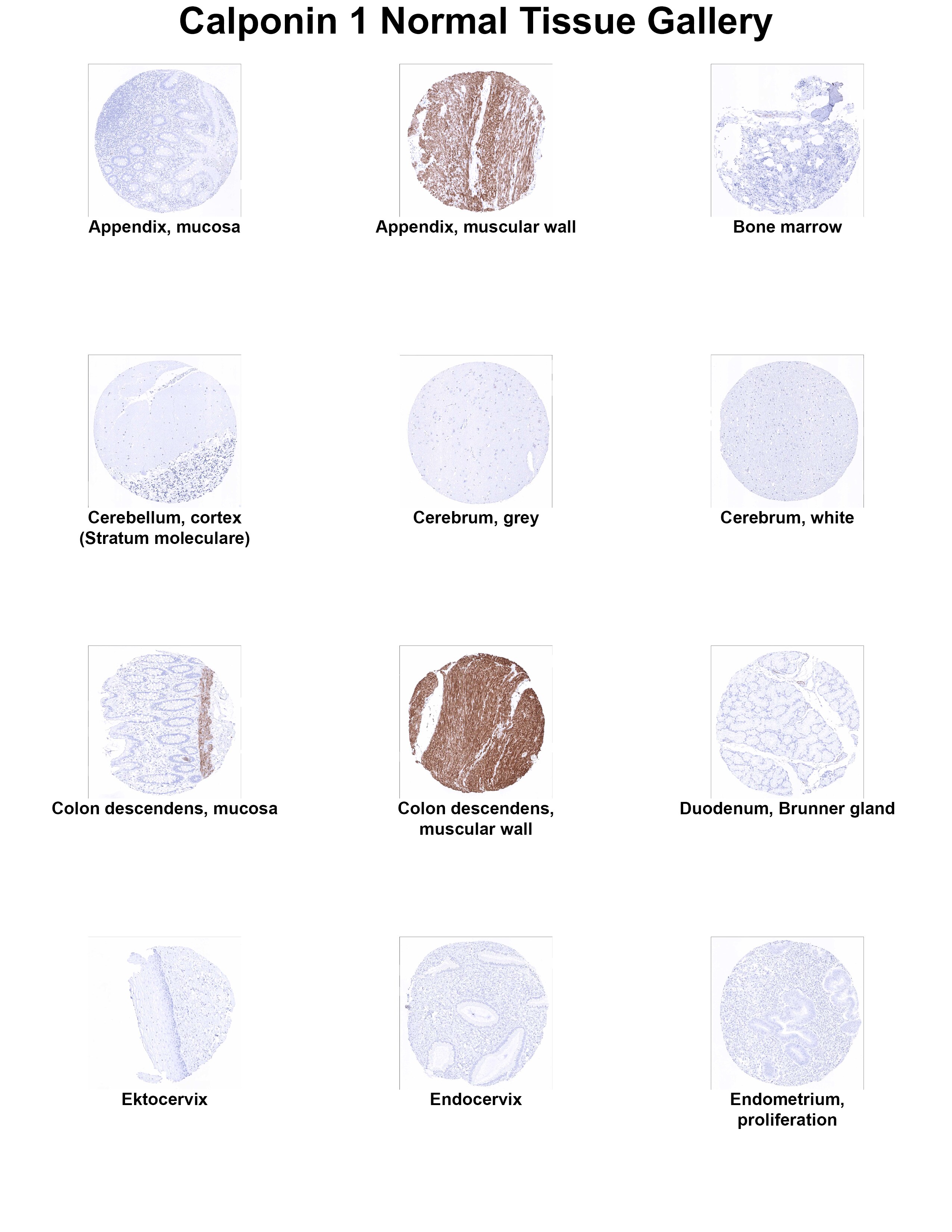 Calponin 1 Antibody (MSVA-455R) - Azide and BSA Free Calponin 1 Antibody (MSVA-455R) - Azide and BSA Free Calponin 1 Normal Tissue Gallery
