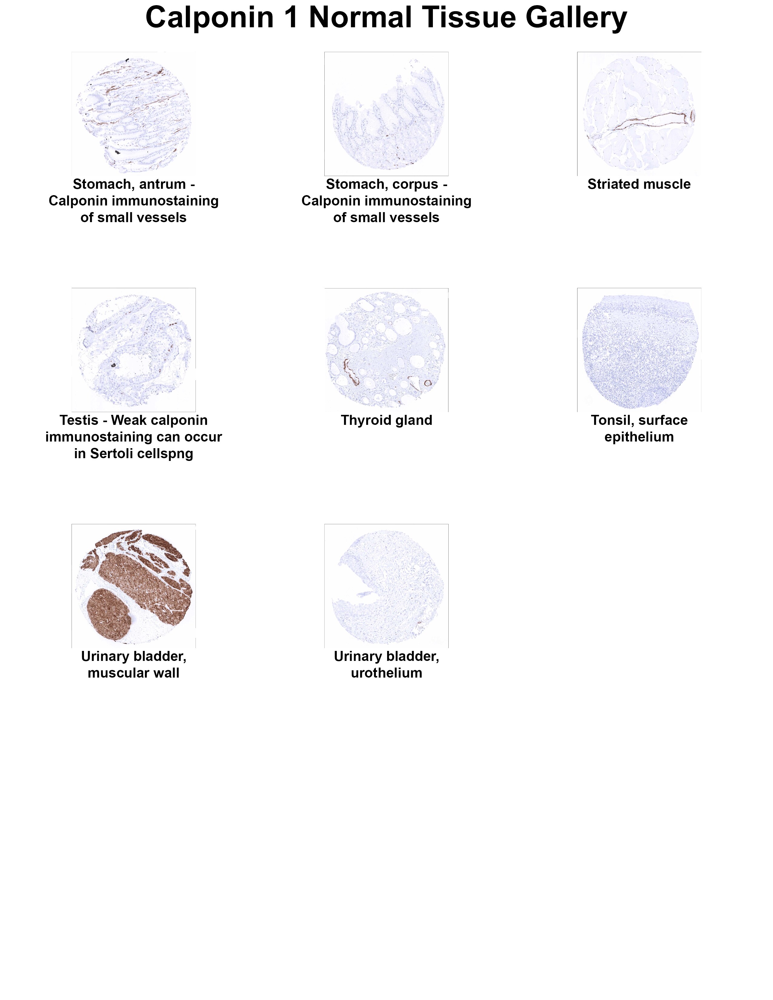 Calponin 1 Antibody (MSVA-455R) - Azide and BSA Free Calponin 1 Antibody (MSVA-455R) - Azide and BSA Free Calponin 1 Normal Tissue Gallery