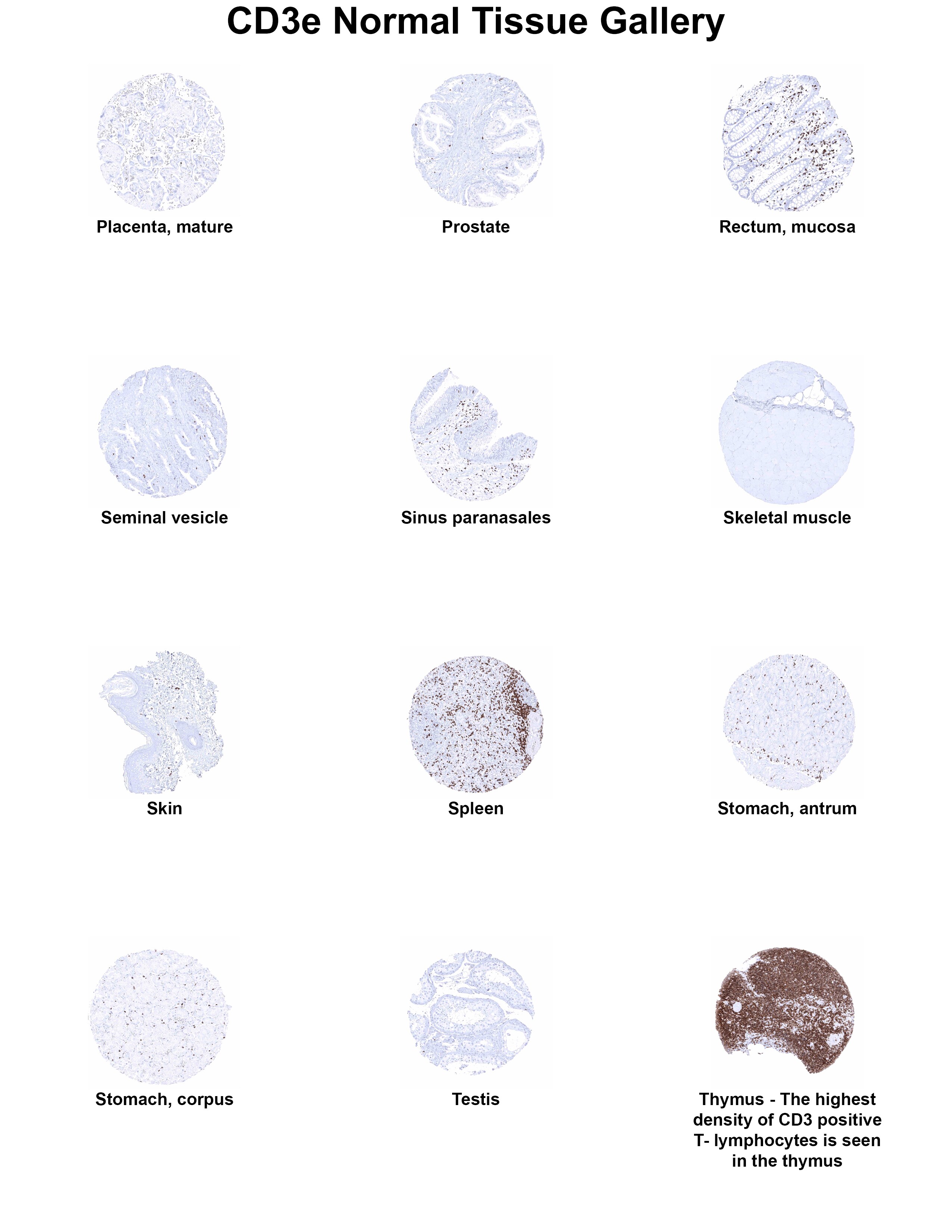 CD3 Antibody (MSVA-003R) - Azide and BSA Free CD3 Antibody (MSVA-003R) - Azide and BSA Free CD3 Normal Tissue Gallery
