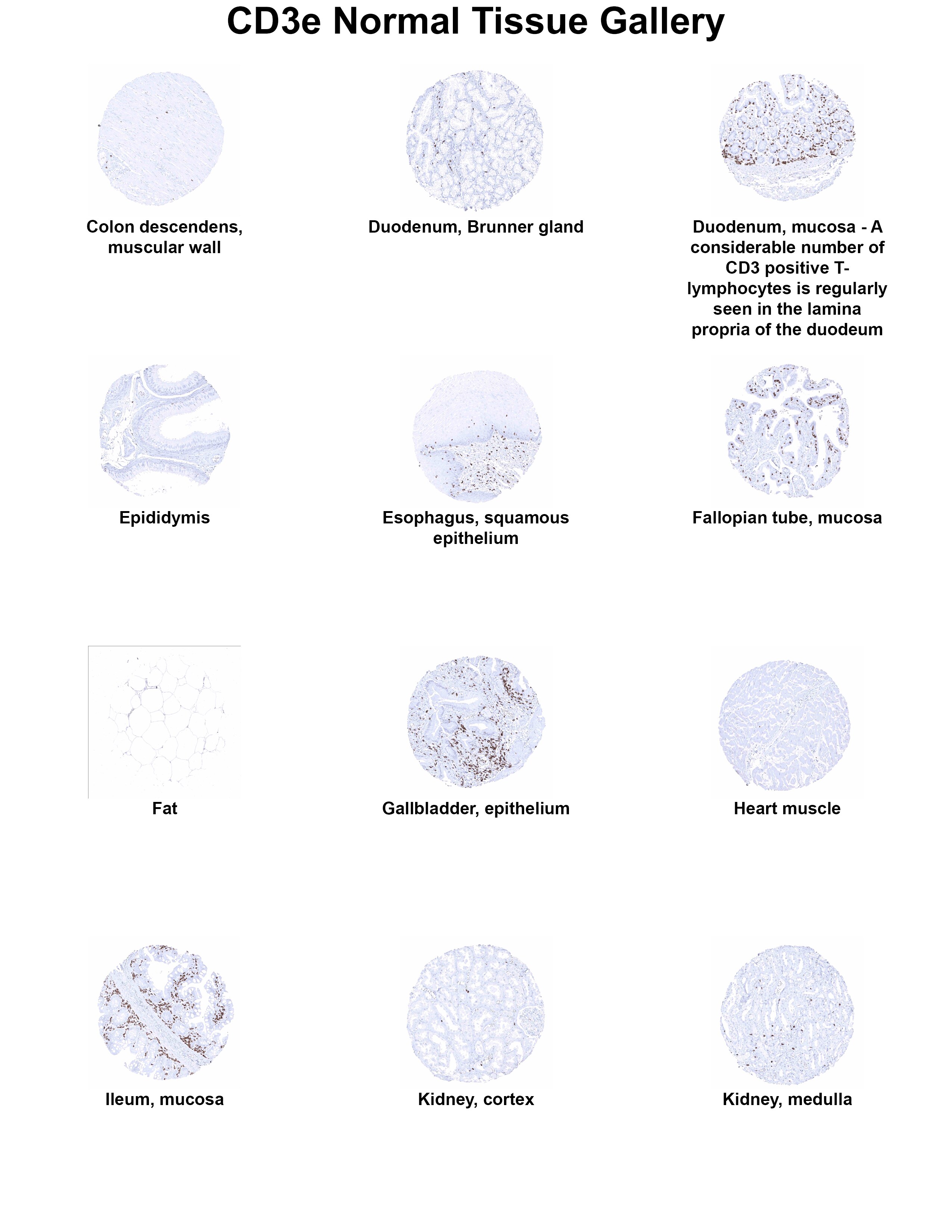 CD3 Antibody (MSVA-003R) - Azide and BSA Free CD3 Antibody (MSVA-003R) - Azide and BSA Free CD3 Normal Tissue Gallery