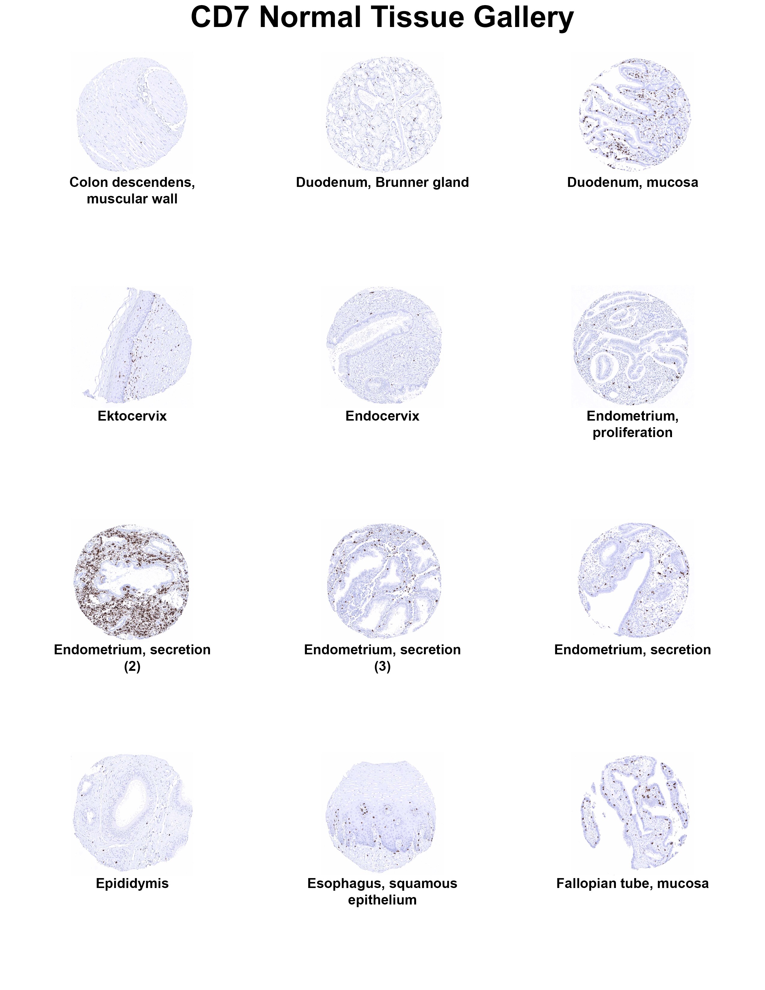 CD7 Antibody (MSVA-007R) - Azide and BSA Free CD7 Antibody (MSVA-007R) - Azide and BSA Free CD7 Normal Tissue Gallery