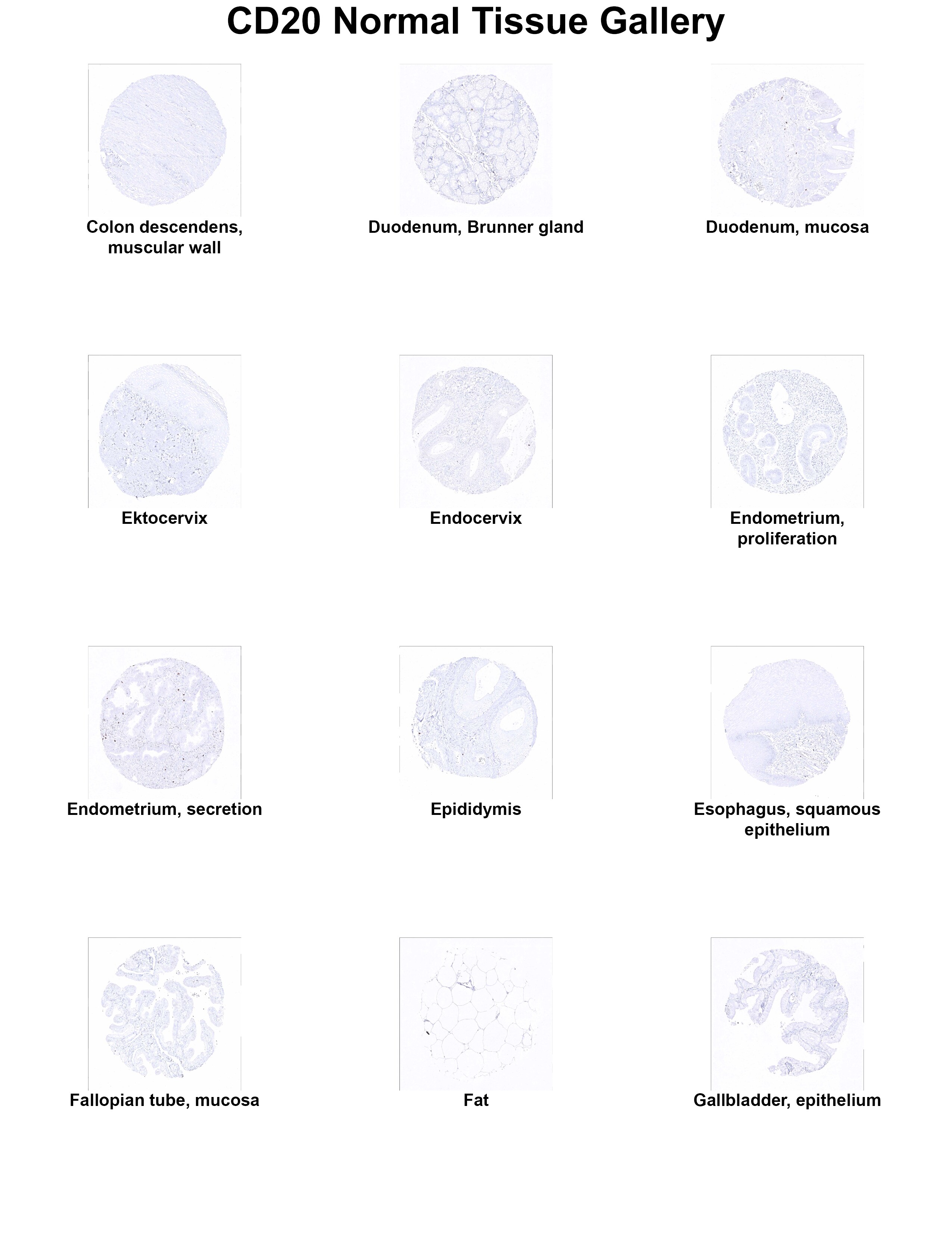 CD20 Antibody (MSVA-020R) - Azide and BSA Free CD20 Antibody (MSVA-020R) - Azide and BSA Free CD20 Normal Tissue Gallery