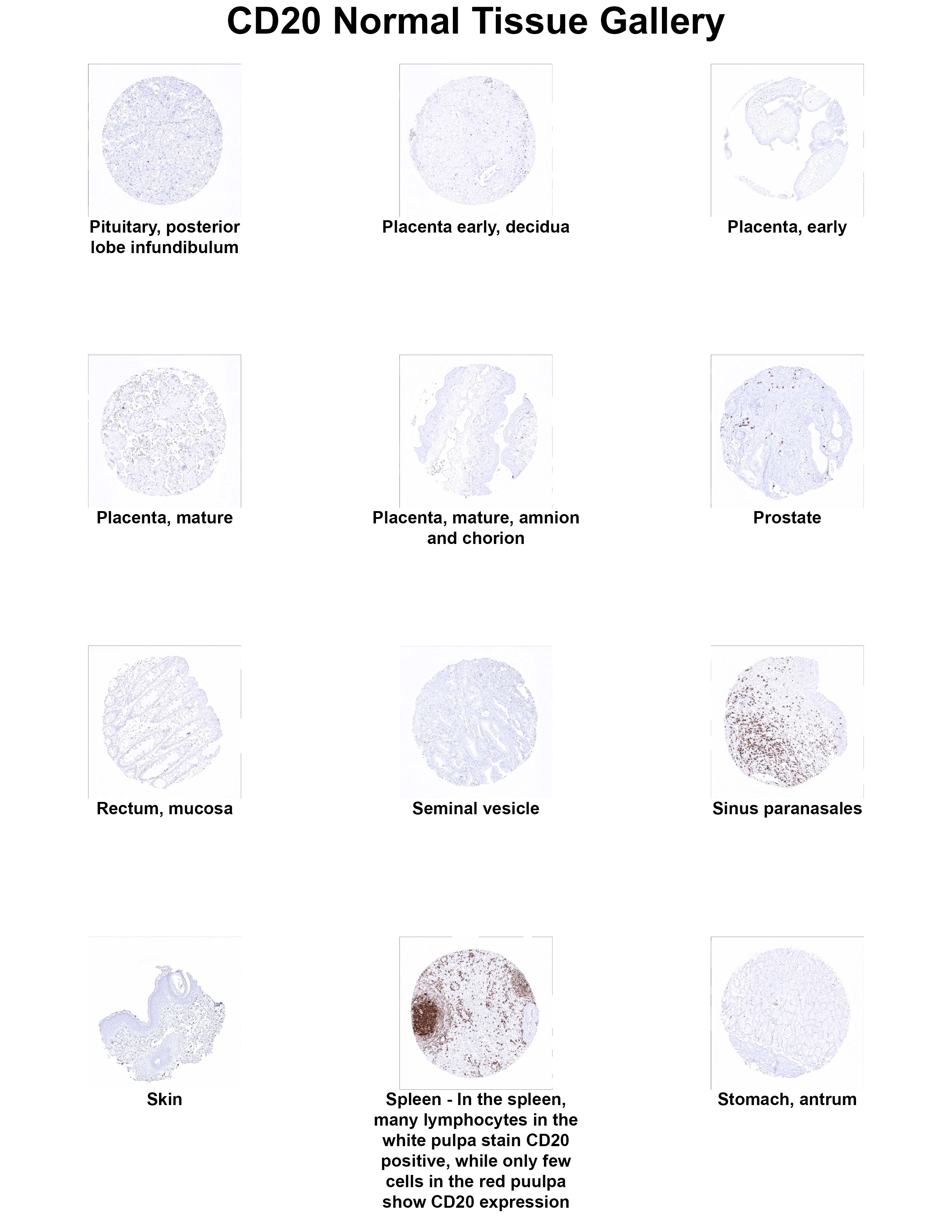 CD20 Antibody (MSVA-020R) - Azide and BSA Free CD20 Antibody (MSVA-020R) - Azide and BSA Free CD20 Normal Tissue Gallery