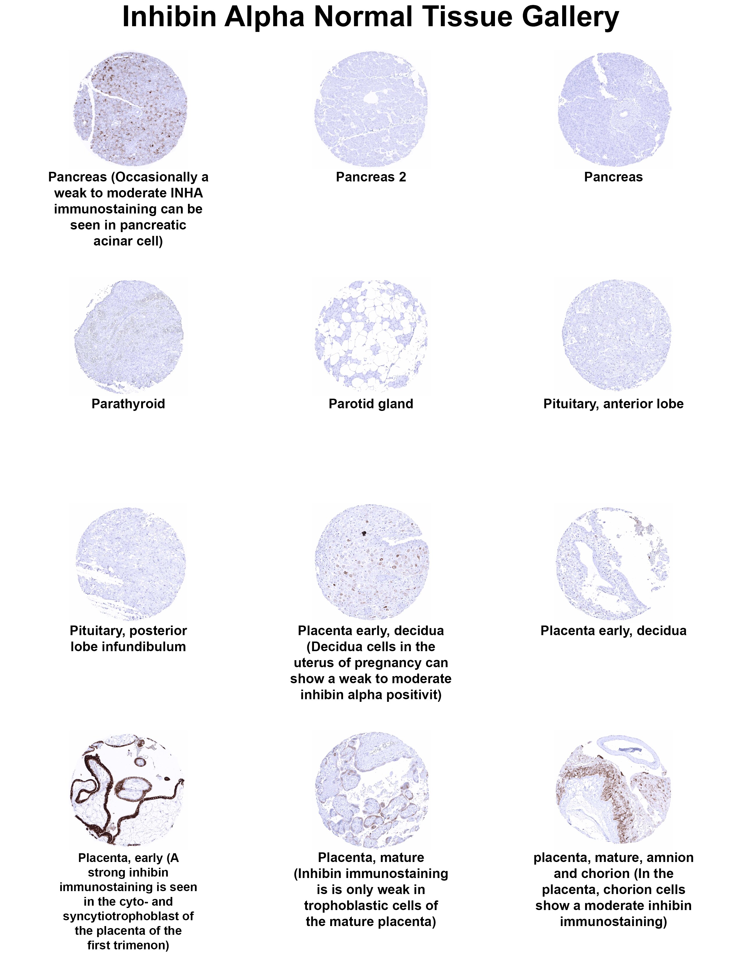 Inhibin alpha Antibody (MSVA-561R) - Azide and BSA Free Inhibin alpha Antibody (MSVA-561R) - Azide and BSA Free Inhibin alpha Normal Tissue Gallery