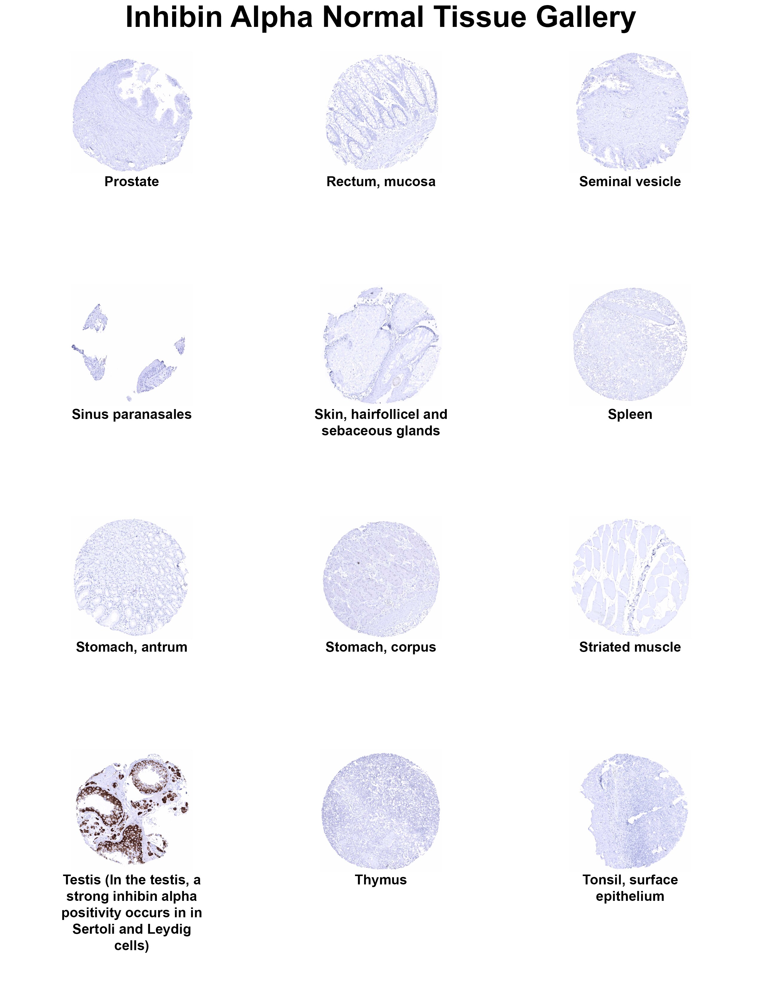 Inhibin alpha Antibody (MSVA-561R) - Azide and BSA Free Inhibin alpha Antibody (MSVA-561R) - Azide and BSA Free Inhibin alpha Normal Tissue Gallery