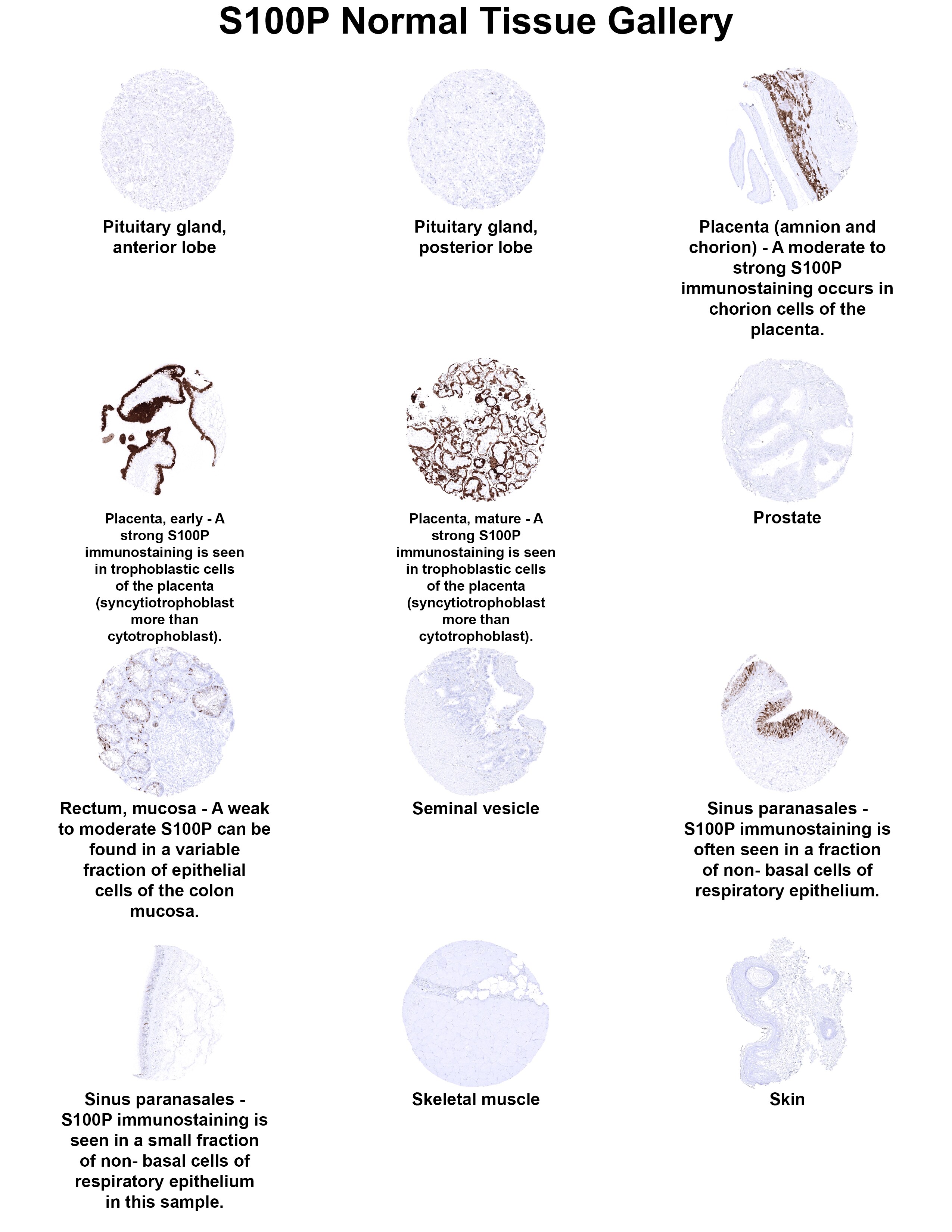S100P Antibody (MSVA-480R) - Azide and BSA Free S100P Antibody (MSVA-480R) - Azide and BSA Free S100P Normal Tissue Gallery