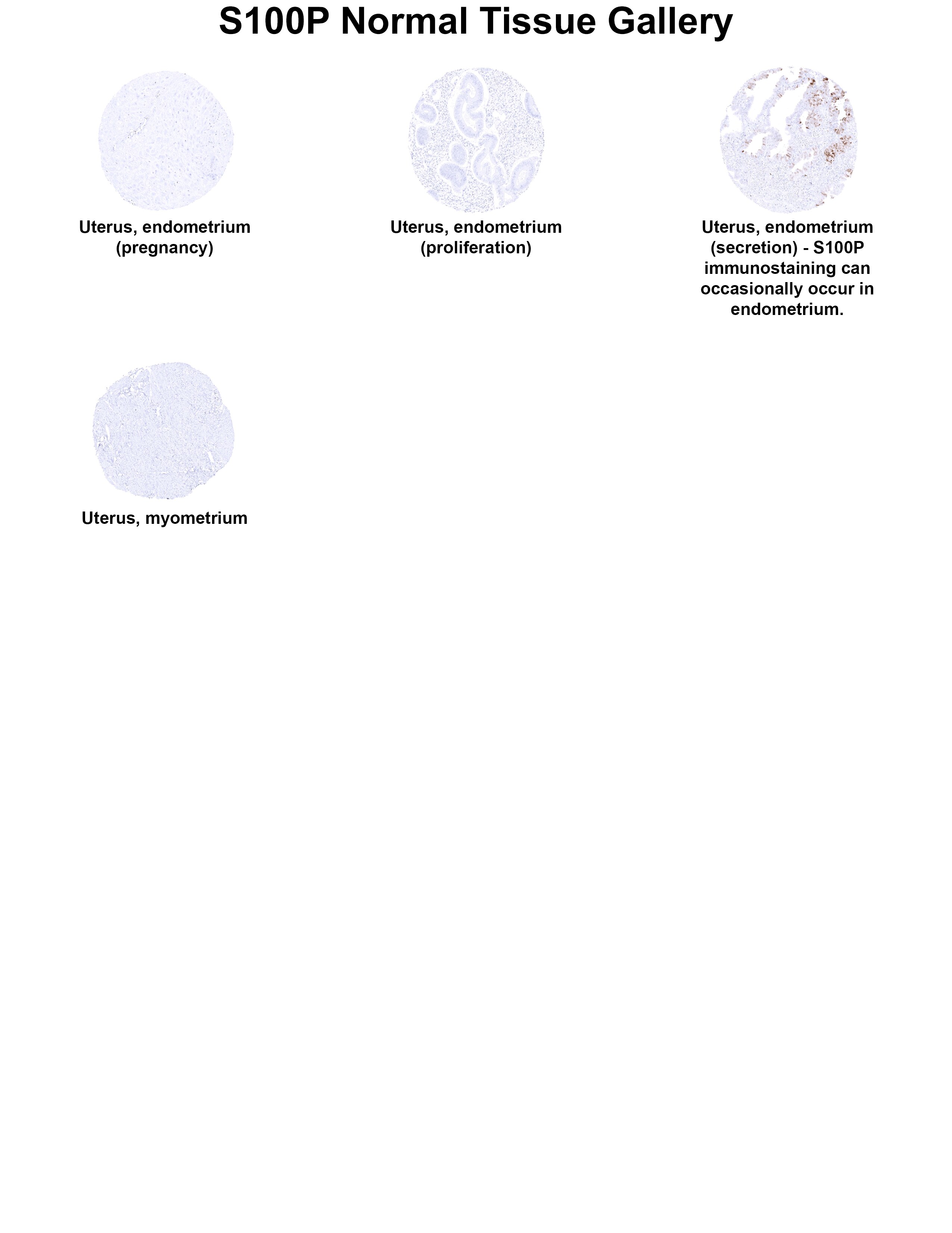 S100P Antibody (MSVA-480R) - Azide and BSA Free S100P Antibody (MSVA-480R) - Azide and BSA Free S100P Normal Tissue Gallery