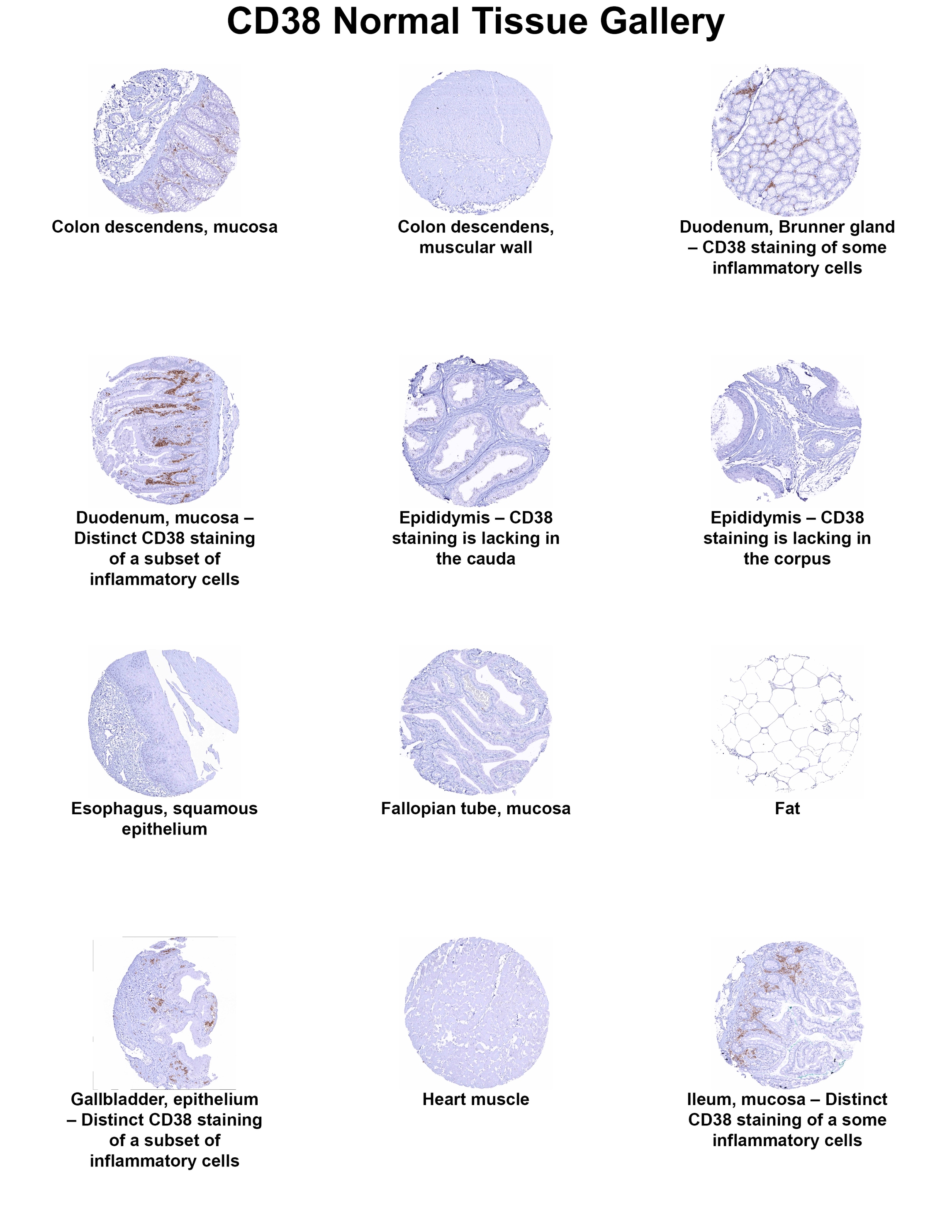 CD38 Antibody (MSVA-038R) - Azide and BSA Free CD38 Antibody (MSVA-038R) - Azide and BSA Free CD38 Normal Tissue Gallery