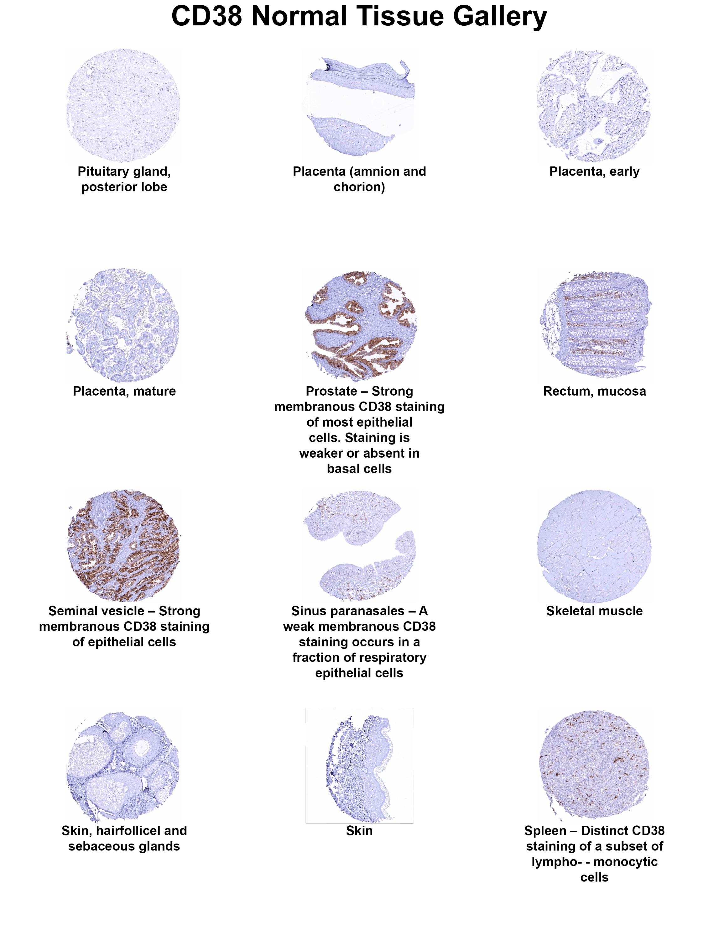 CD38 Antibody (MSVA-038R) - Azide and BSA Free CD38 Antibody (MSVA-038R) - Azide and BSA Free CD38 Normal Tissue Gallery