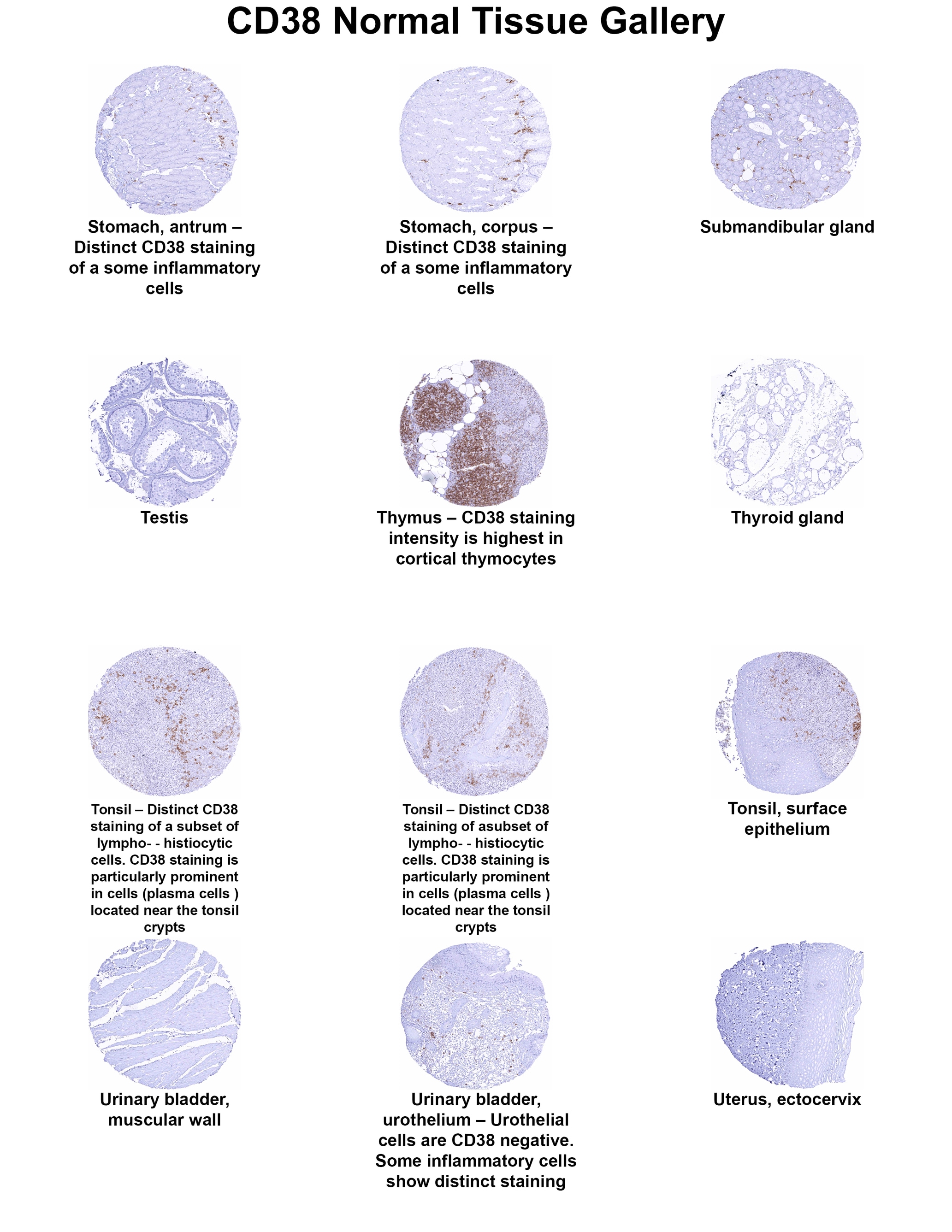 CD38 Antibody (MSVA-038R) - Azide and BSA Free CD38 Antibody (MSVA-038R) - Azide and BSA Free CD38 Normal Tissue Gallery