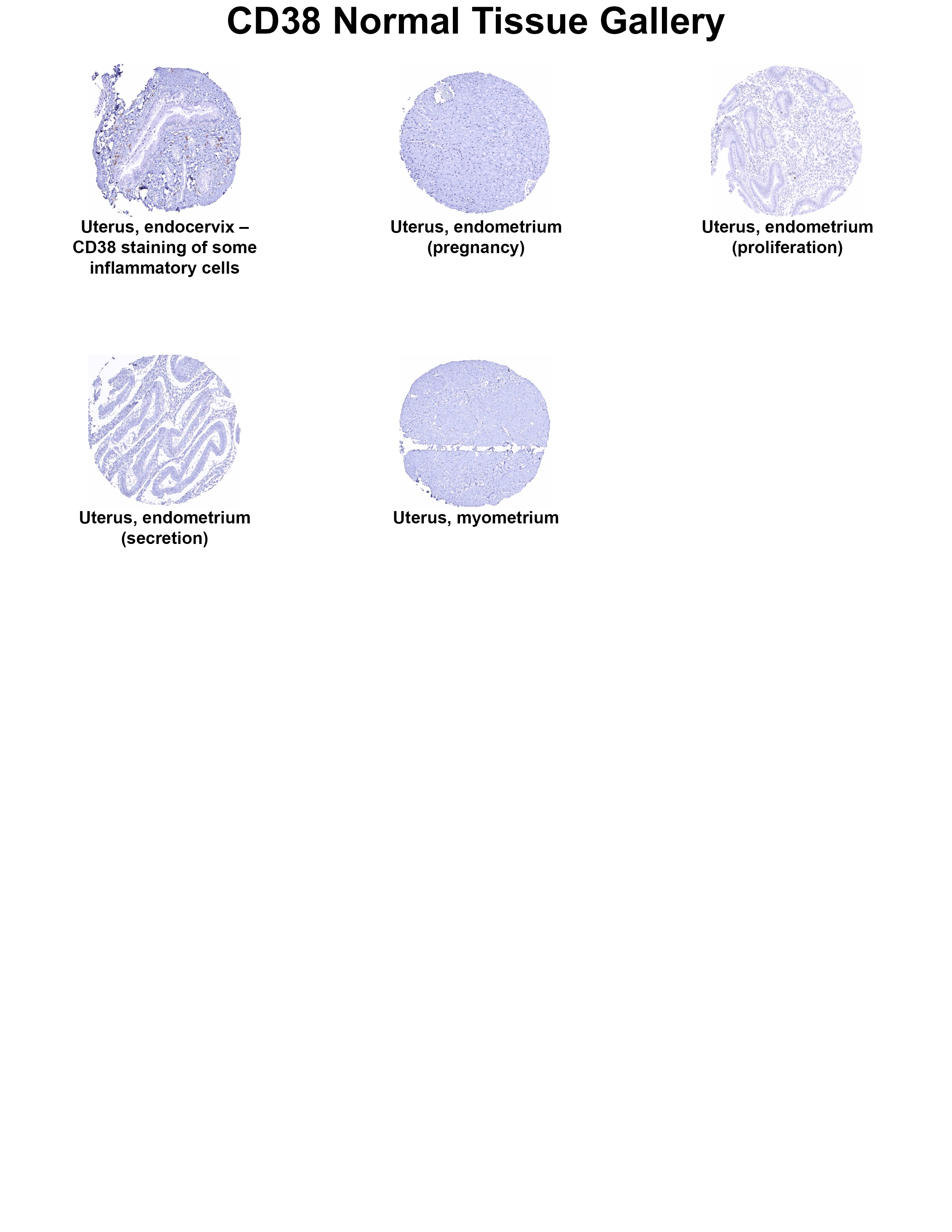 CD38 Antibody (MSVA-038R) - Azide and BSA Free CD38 Antibody (MSVA-038R) - Azide and BSA Free CD38 Normal Tissue Gallery