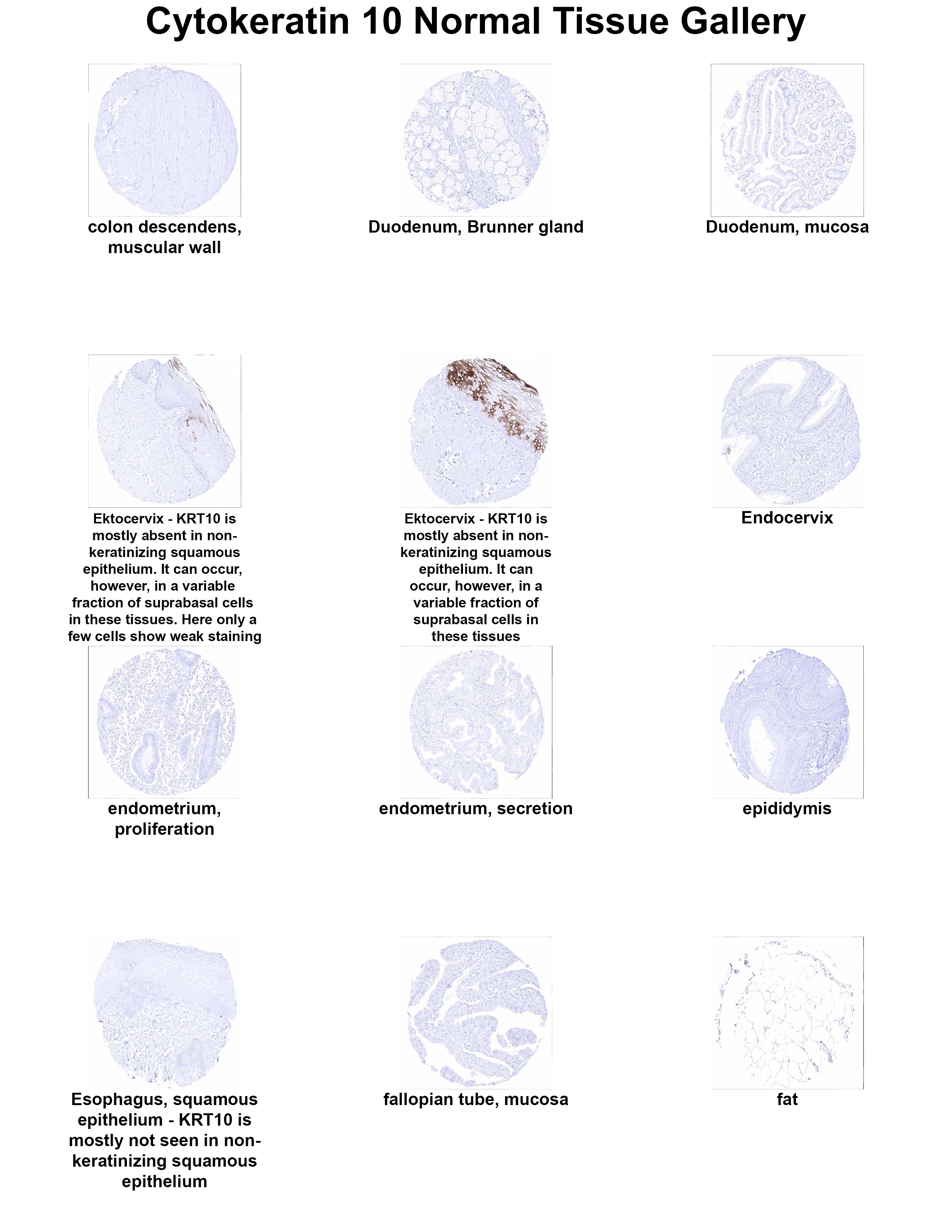 Cytokeratin 10 Antibody (MSVA-610M) - Azide and BSA Free Cytokeratin 10 Antibody (MSVA-610M) - Azide and BSA Free Cytokeratin 10 Normal Tissue Gallery