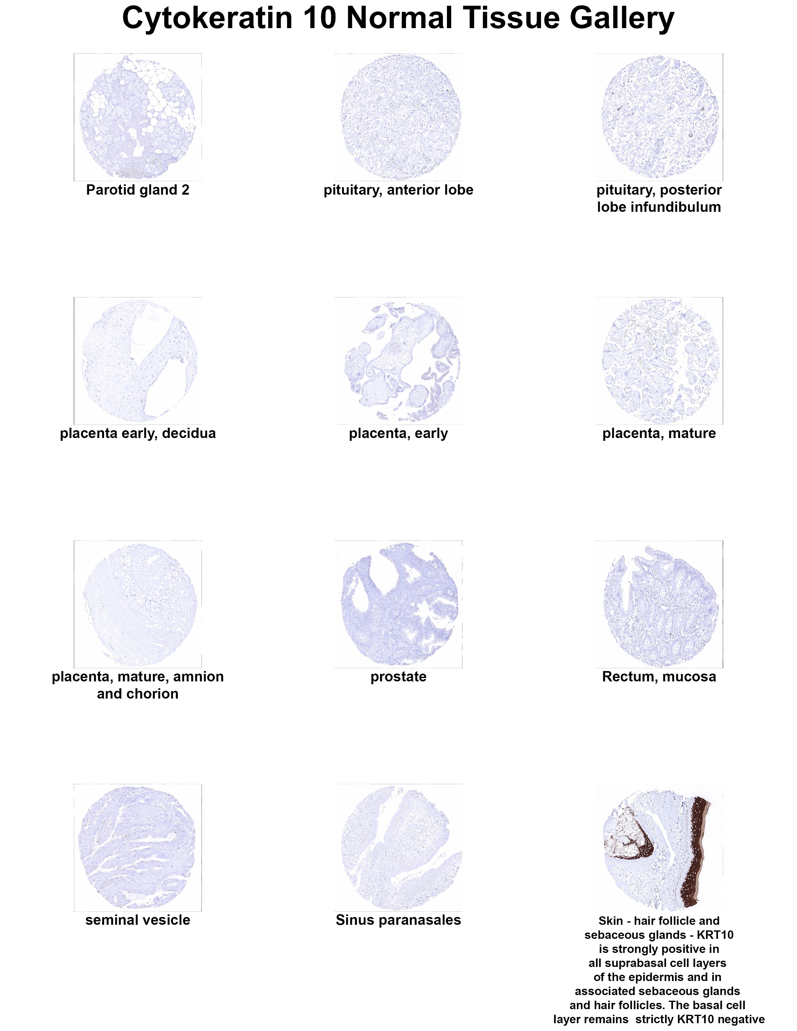 Cytokeratin 10 Antibody (MSVA-610M) - Azide and BSA Free Cytokeratin 10 Antibody (MSVA-610M) - Azide and BSA Free Cytokeratin 10 Normal Tissue Gallery