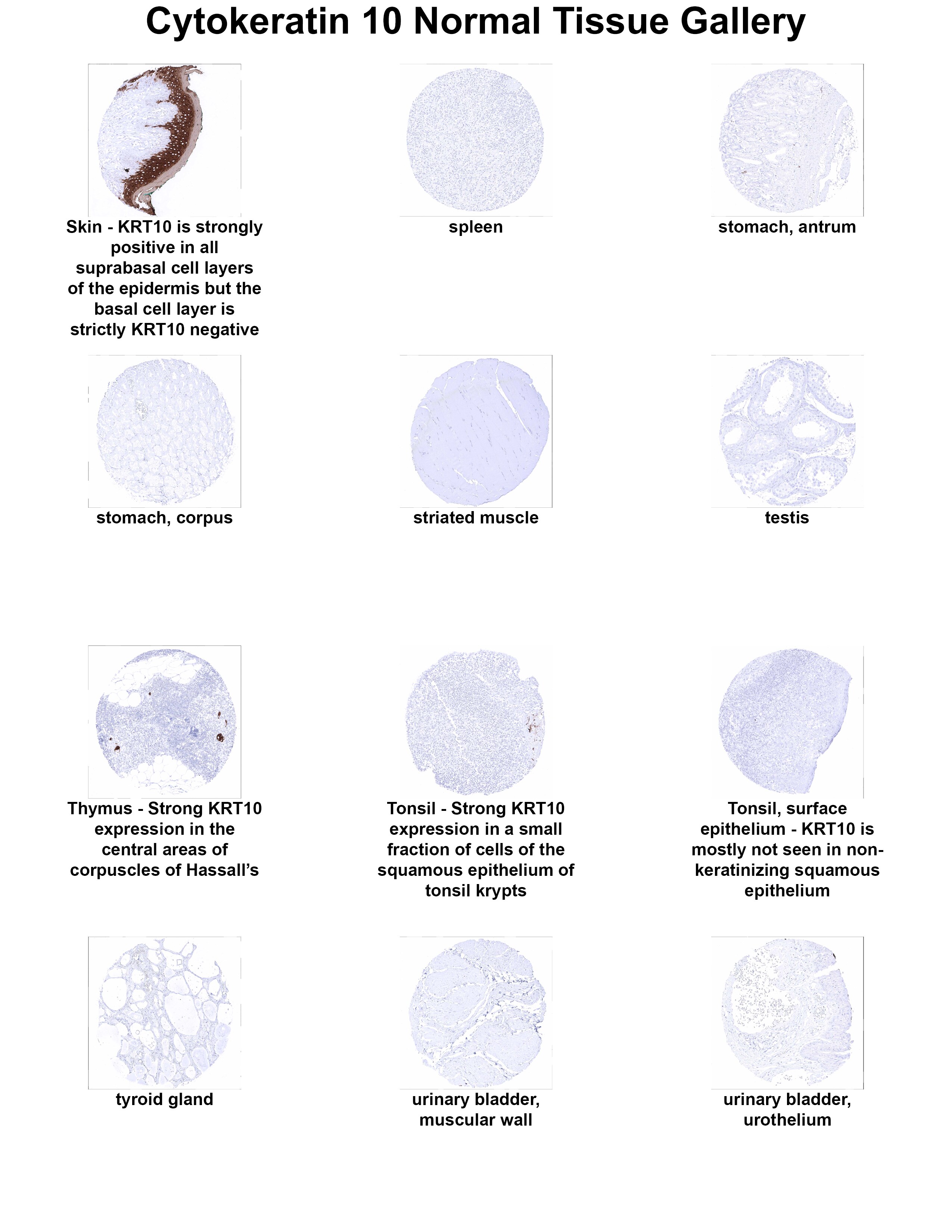 Cytokeratin 10 Antibody (MSVA-610M) - Azide and BSA Free Cytokeratin 10 Antibody (MSVA-610M) - Azide and BSA Free Cytokeratin 10 Normal Tissue Gallery