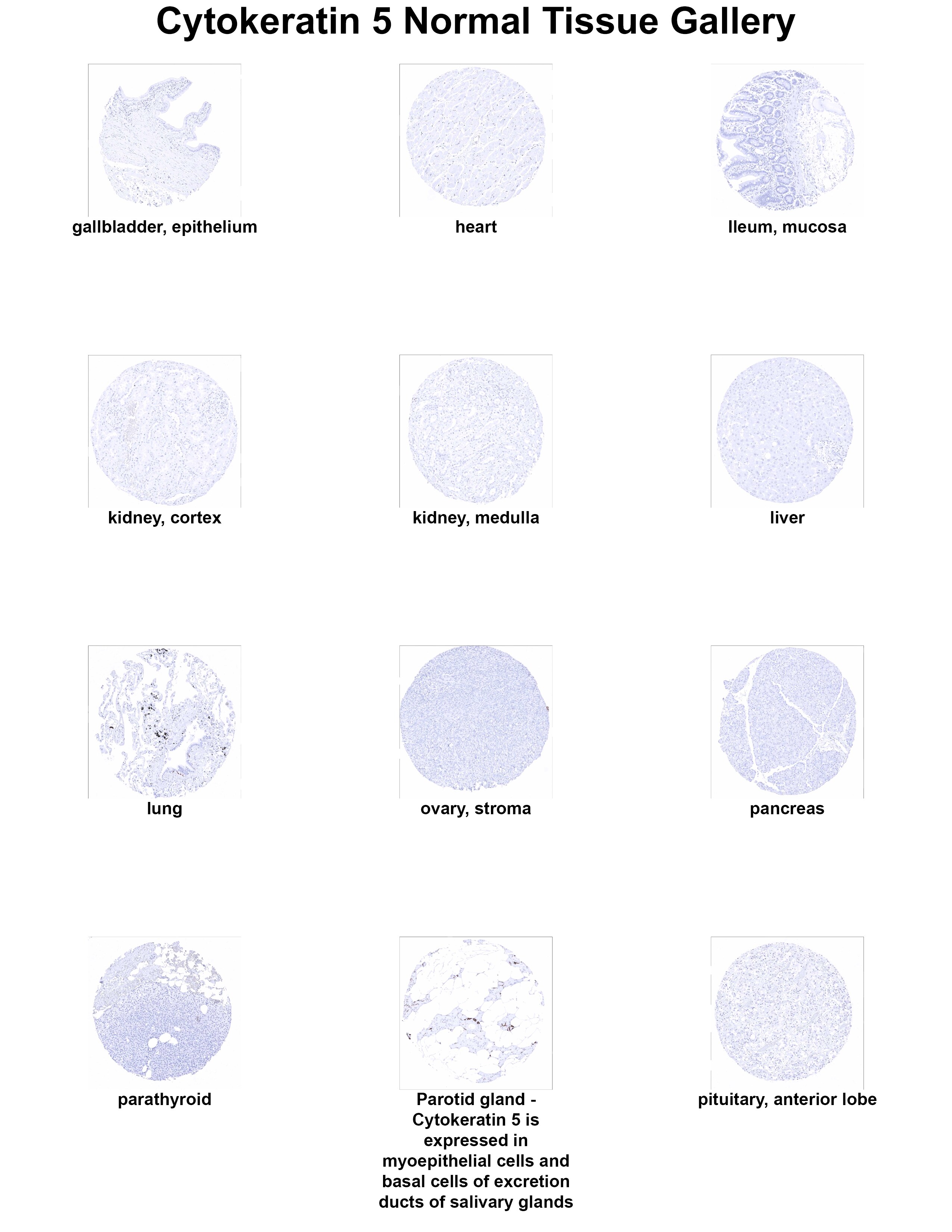 Cytokeratin 5 Antibody (MSVA-605M) - Azide and BSA Free Cytokeratin 5 Antibody (MSVA-605M) - Azide and BSA Free Cytokeratin 5 Normal Tissue Gallery
