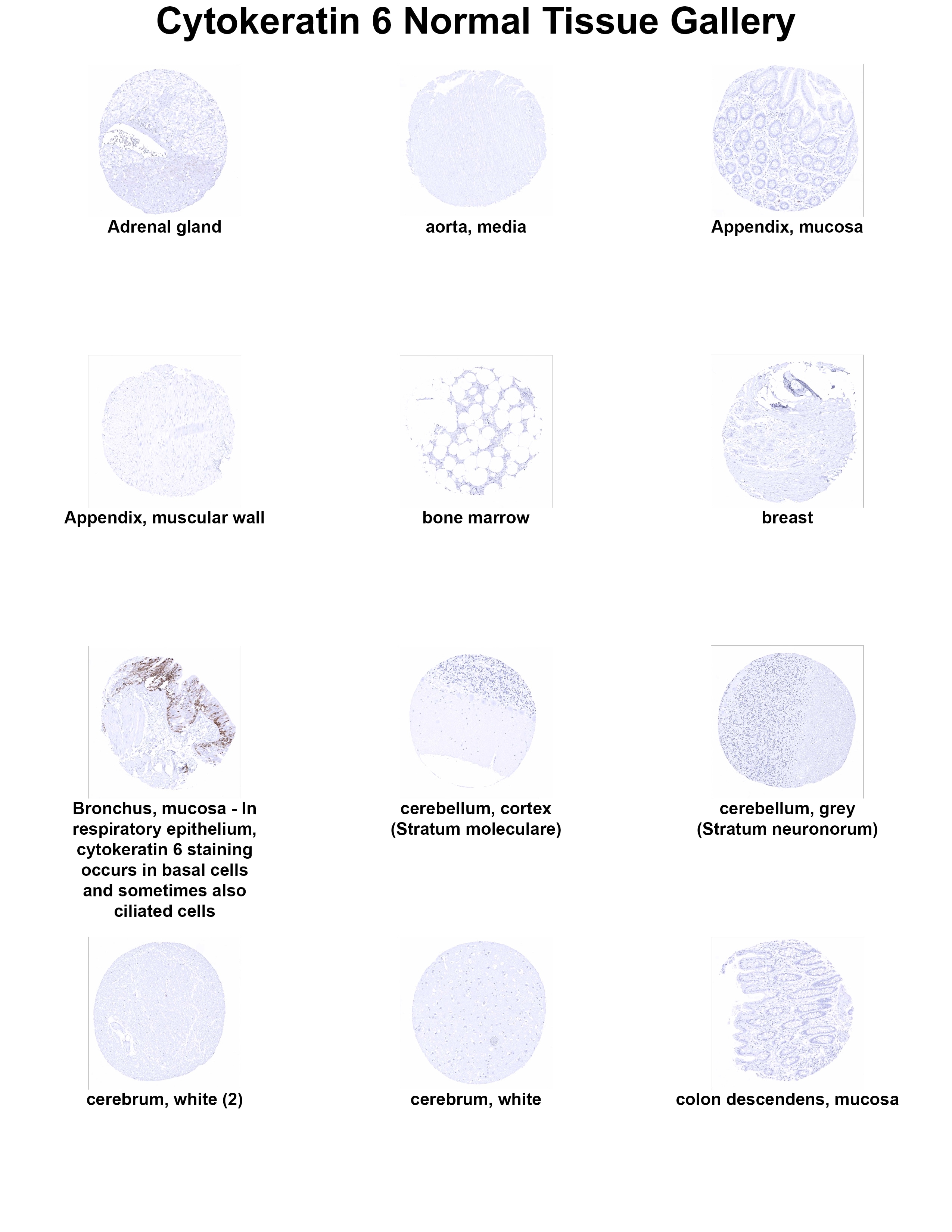 Cytokeratin 6 Antibody (MSVA-606R) - Azide and BSA Free Cytokeratin 6 Antibody (MSVA-606R) - Azide and BSA Free Cytokeratin 6 Normal Tissue Gallery