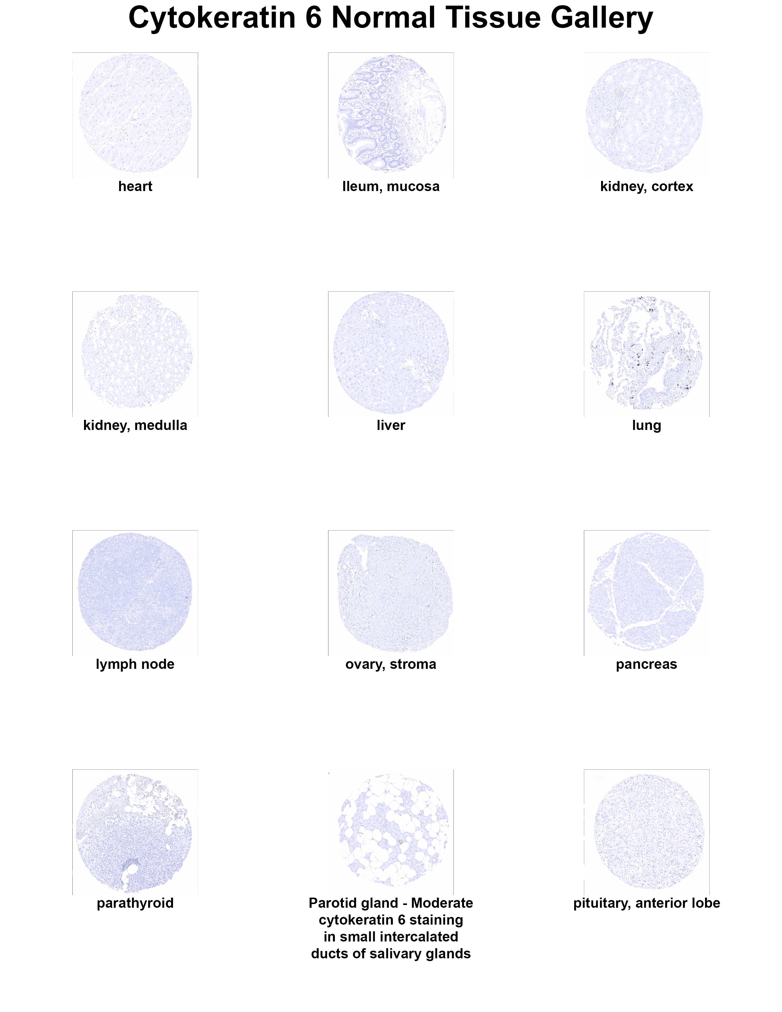 Cytokeratin 6 Antibody (MSVA-606R) - Azide and BSA Free Cytokeratin 6 Antibody (MSVA-606R) - Azide and BSA Free Cytokeratin 6 Normal Tissue Gallery