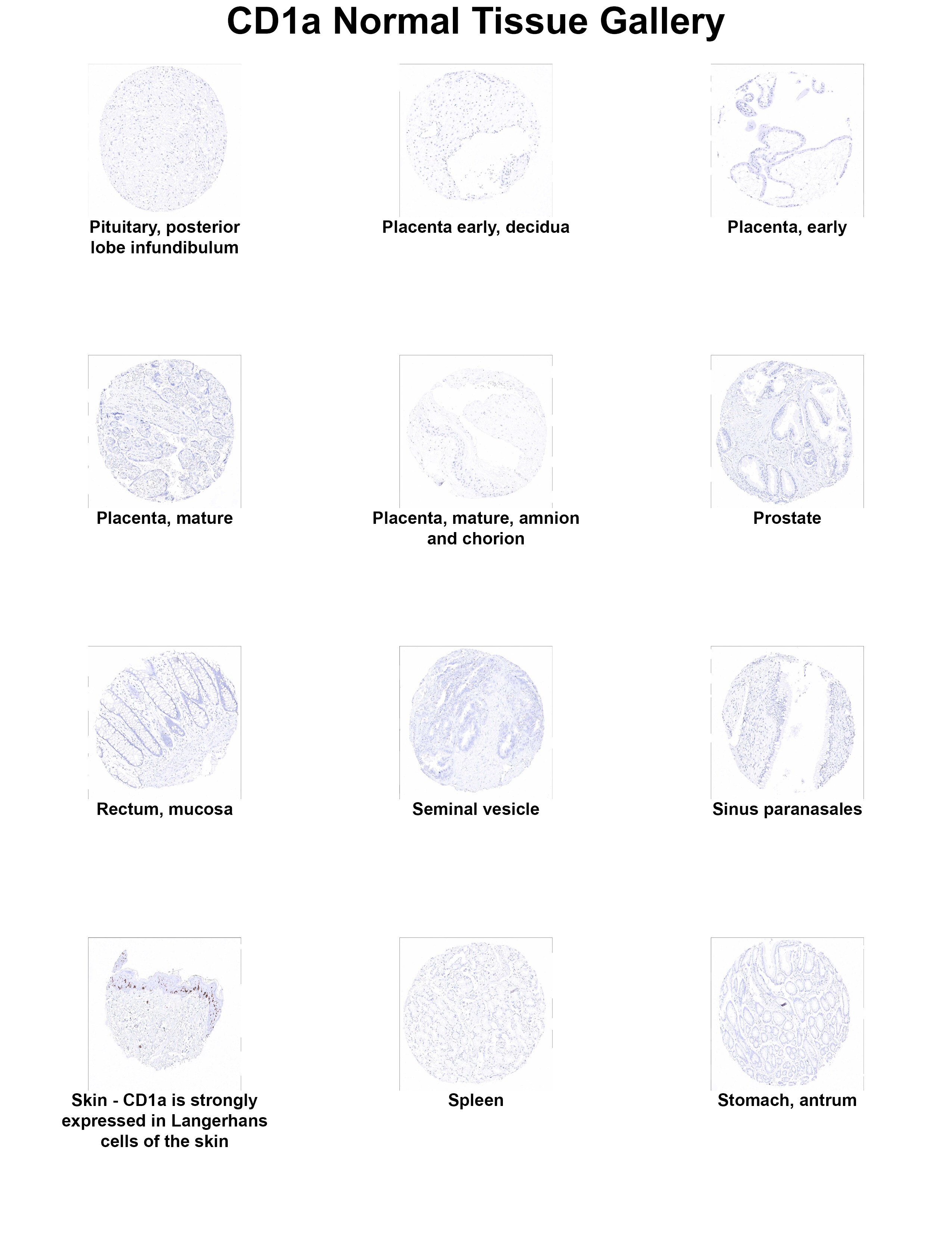 CD1a Antibody (MSVA-001M) - Azide and BSA Free CD1a Antibody (MSVA-001M) - Azide and BSA Free CD1a Normal Tissue Gallery