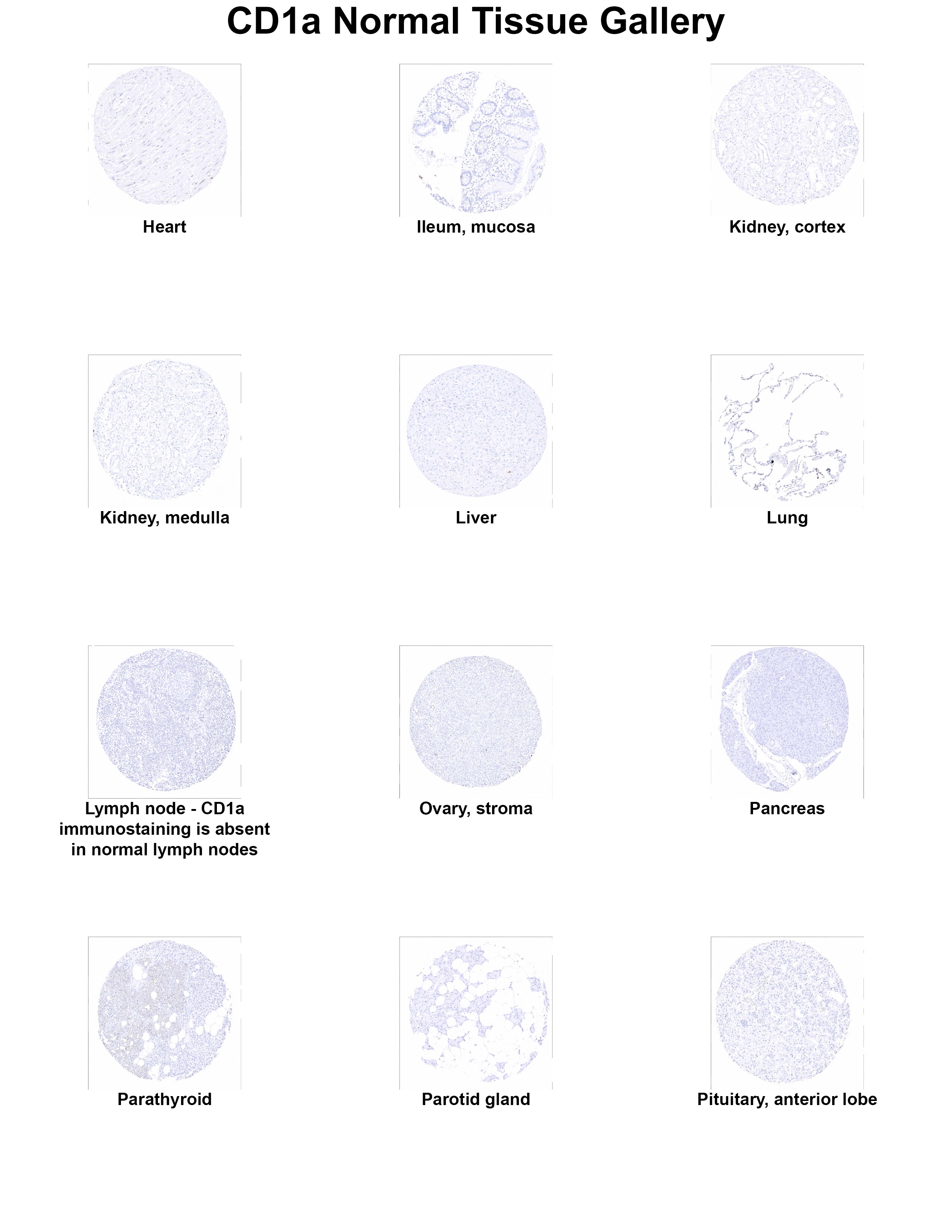 CD1a Antibody (MSVA-001M) - Azide and BSA Free CD1a Antibody (MSVA-001M) - Azide and BSA Free CD1a Normal Tissue Gallery