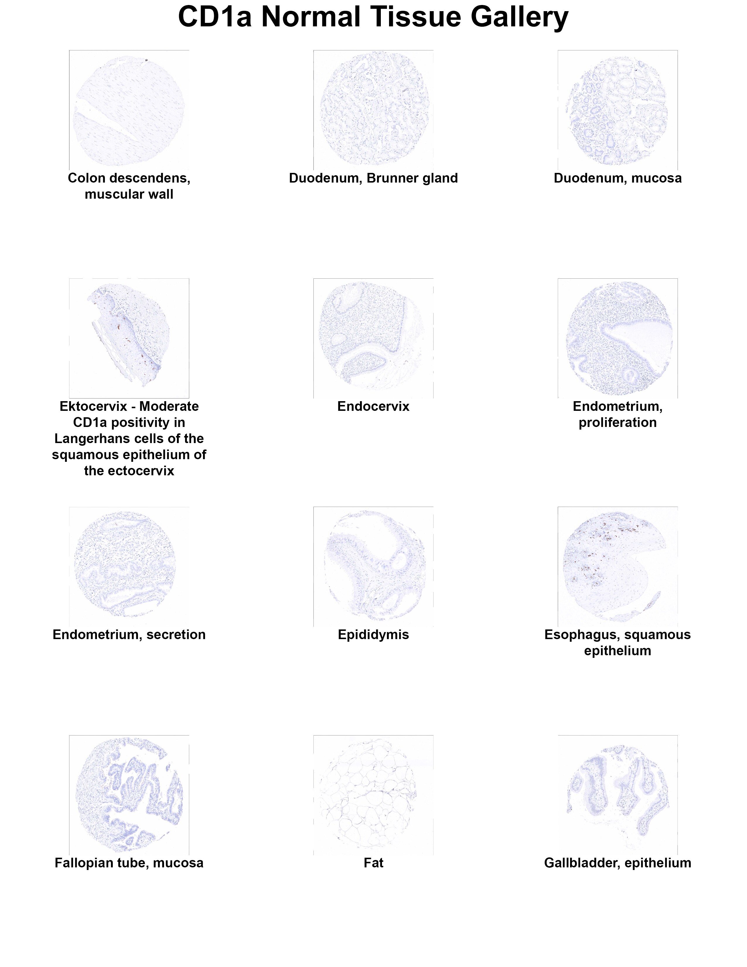 CD1a Antibody (MSVA-001M) - Azide and BSA Free CD1a Antibody (MSVA-001M) - Azide and BSA Free CD1a Normal Tissue Gallery