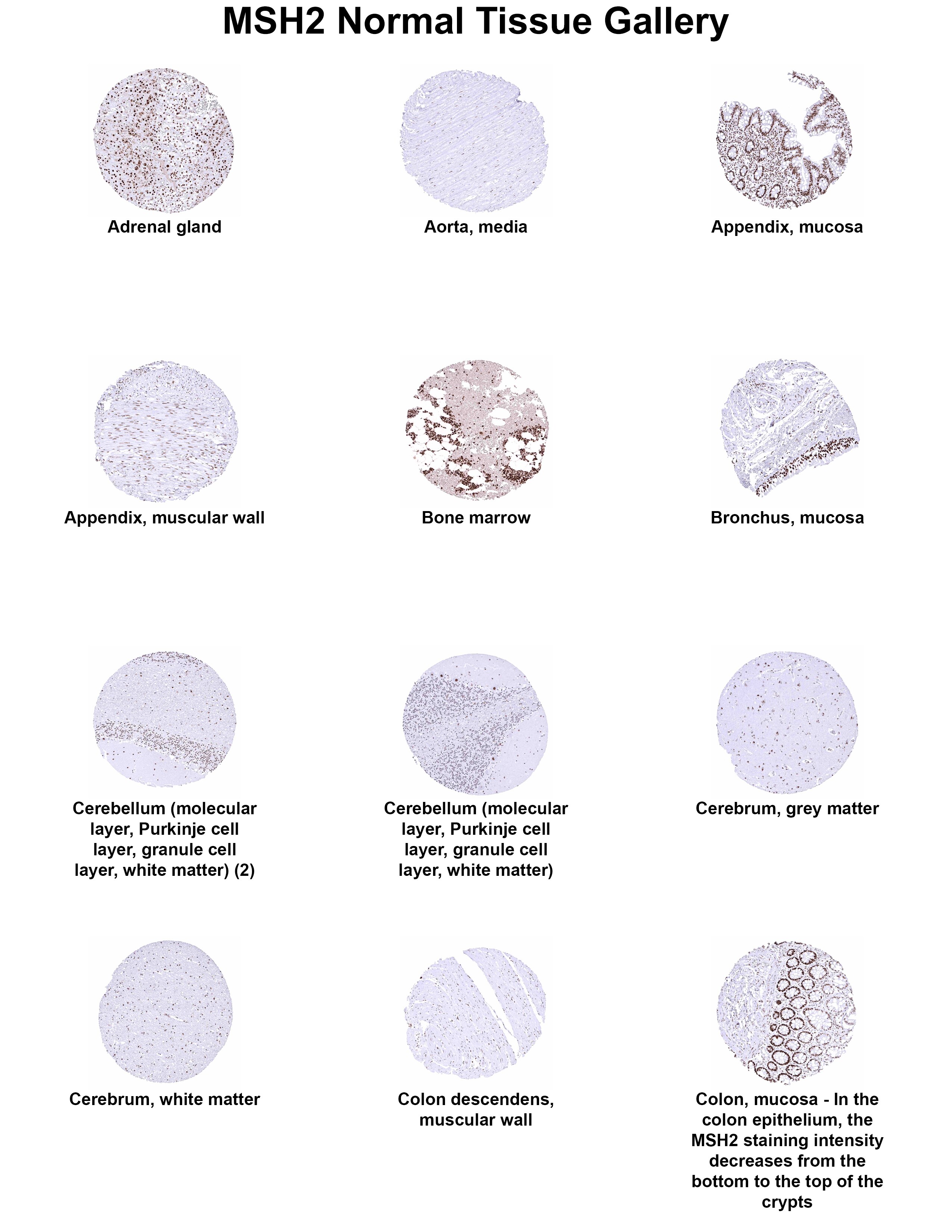 MSH2 Antibody (MSVA-902M) - Azide and BSA Free MSH2 Antibody (MSVA-902M) - Azide and BSA Free MSH2 Normal Tissue Gallery