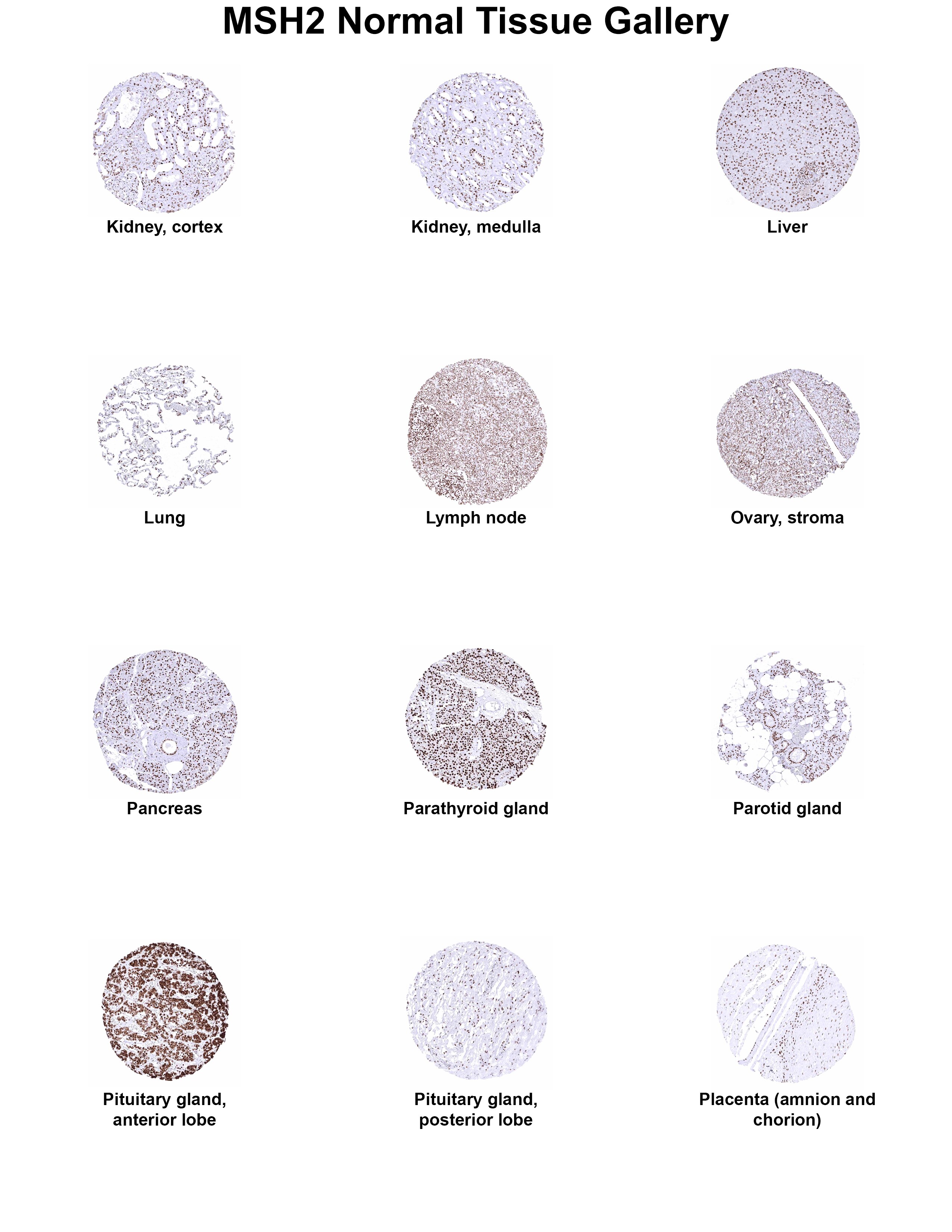 MSH2 Antibody (MSVA-902M) - Azide and BSA Free MSH2 Antibody (MSVA-902M) - Azide and BSA Free MSH2 Normal Tissue Gallery