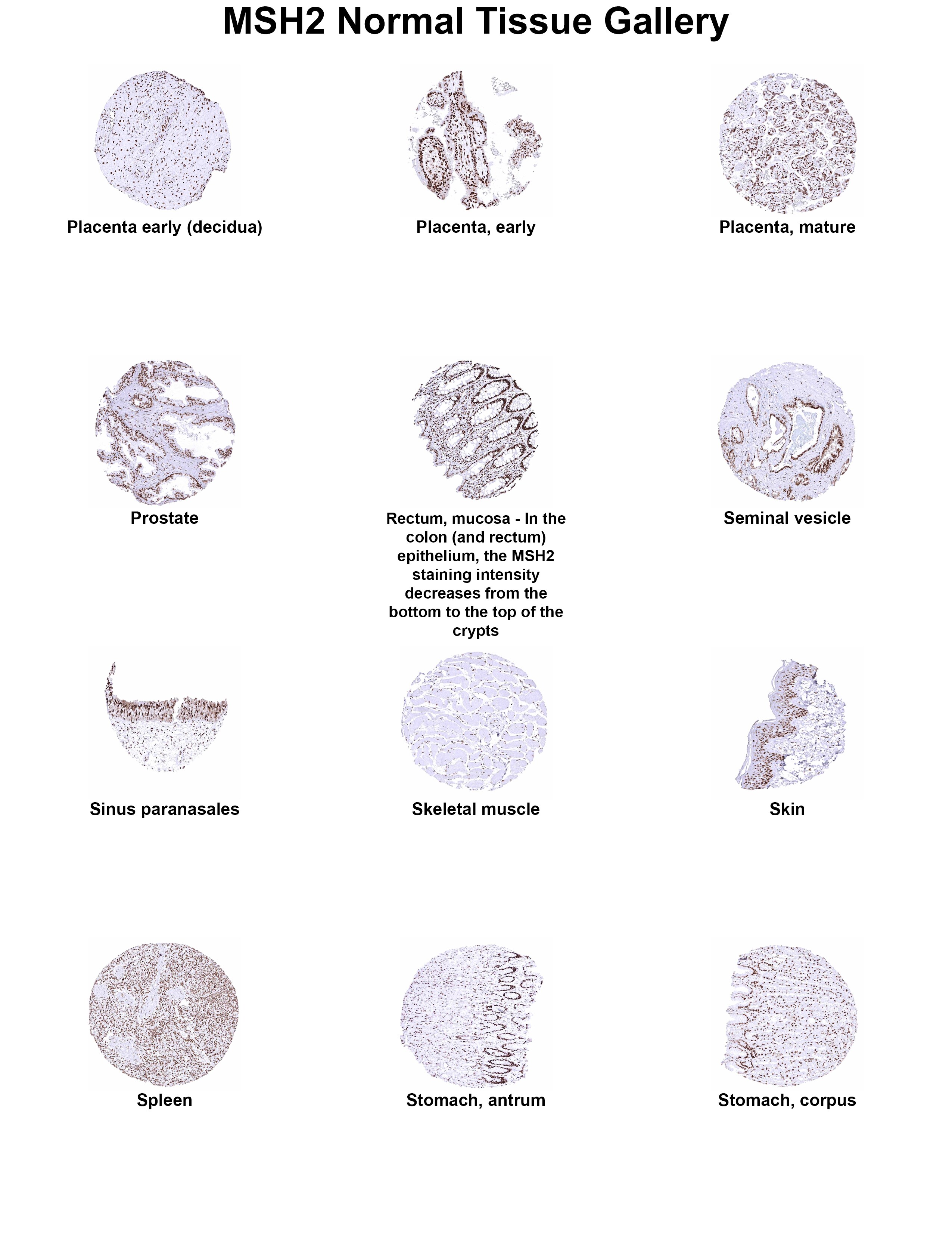 MSH2 Antibody (MSVA-902M) - Azide and BSA Free MSH2 Antibody (MSVA-902M) - Azide and BSA Free MSH2 Normal Tissue Gallery