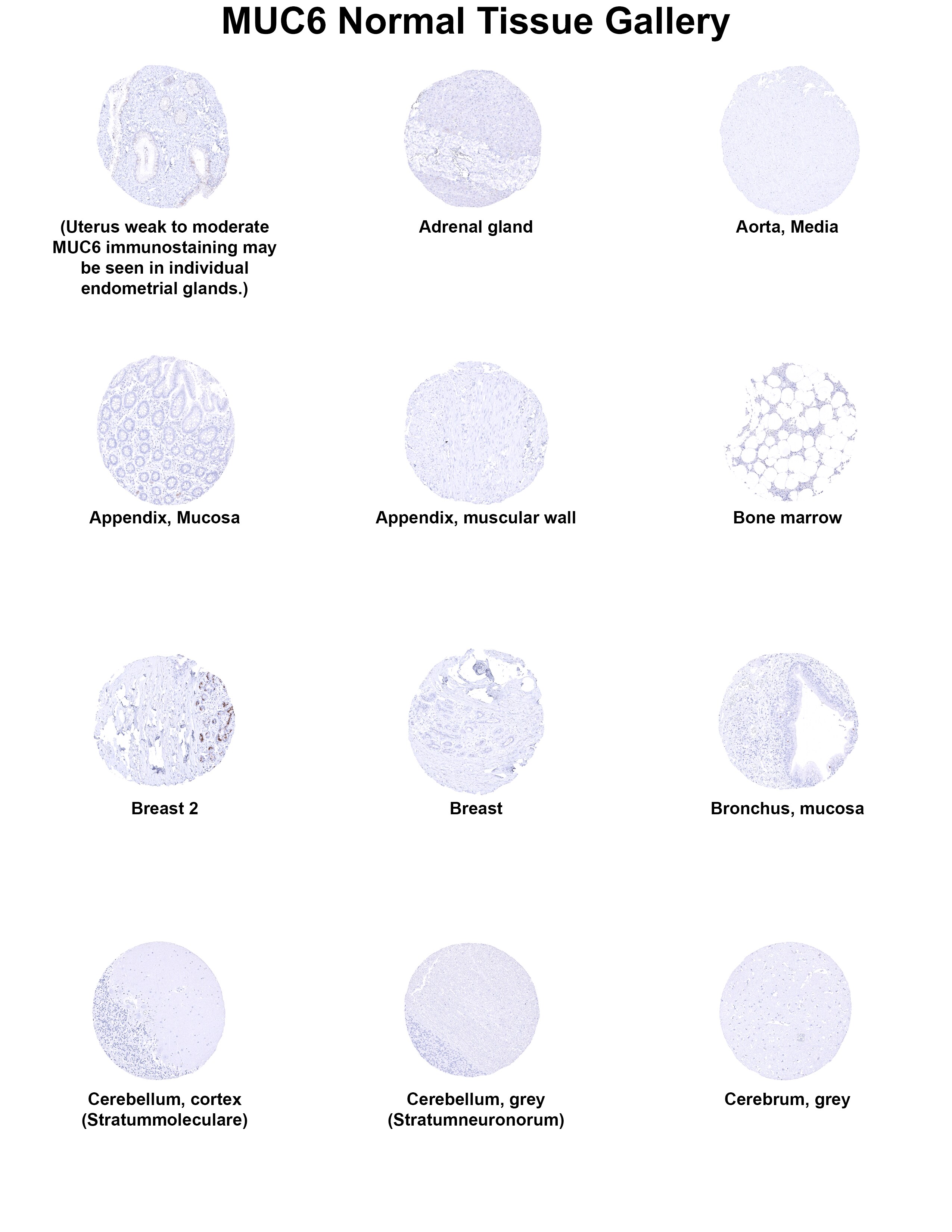 MUC6 Antibody (MSVA-806R) - Azide and BSA Free MUC6 Antibody (MSVA-806R) - Azide and BSA Free MUC6 Normal Tissue Gallery