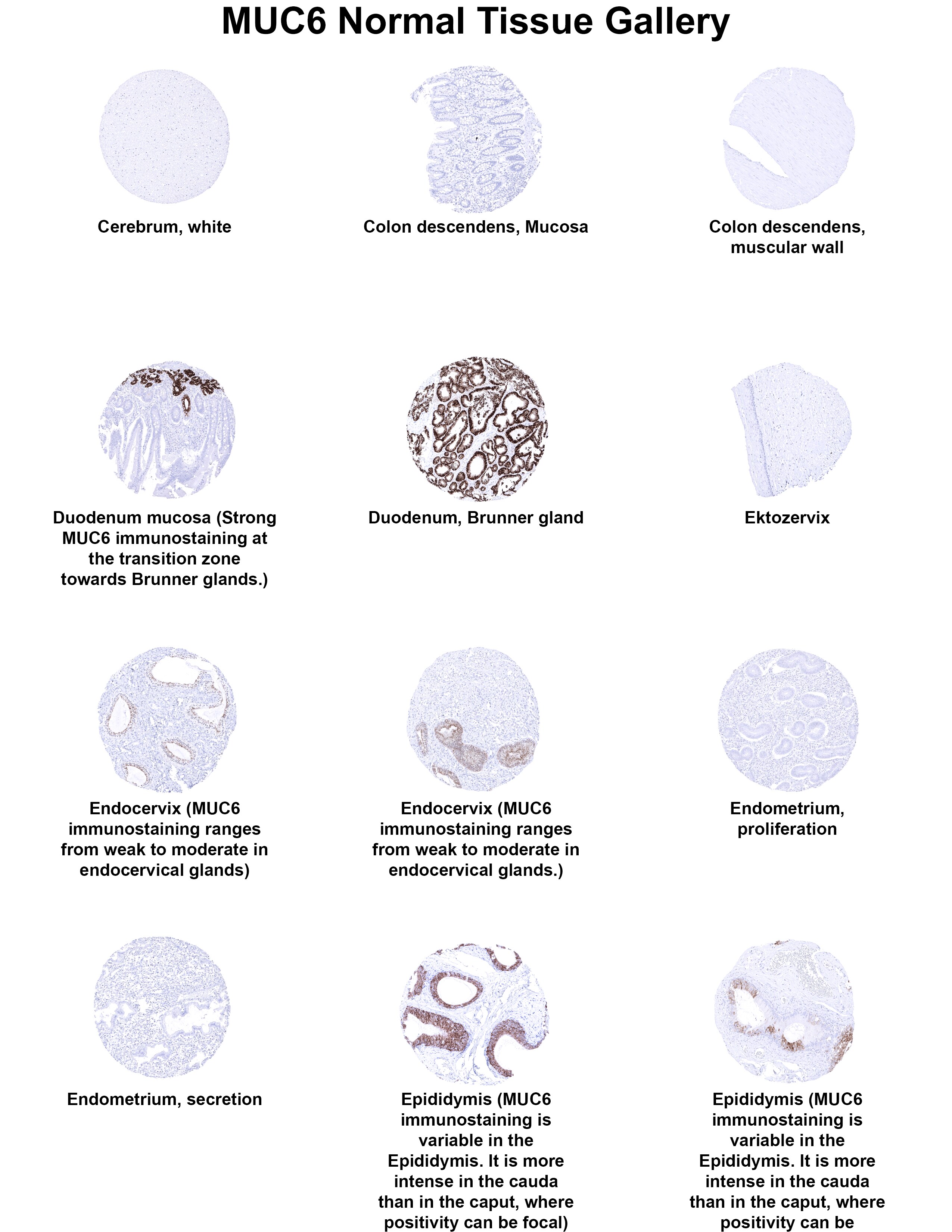 MUC6 Antibody (MSVA-806R) - Azide and BSA Free MUC6 Antibody (MSVA-806R) - Azide and BSA Free MUC6 Normal Tissue Gallery