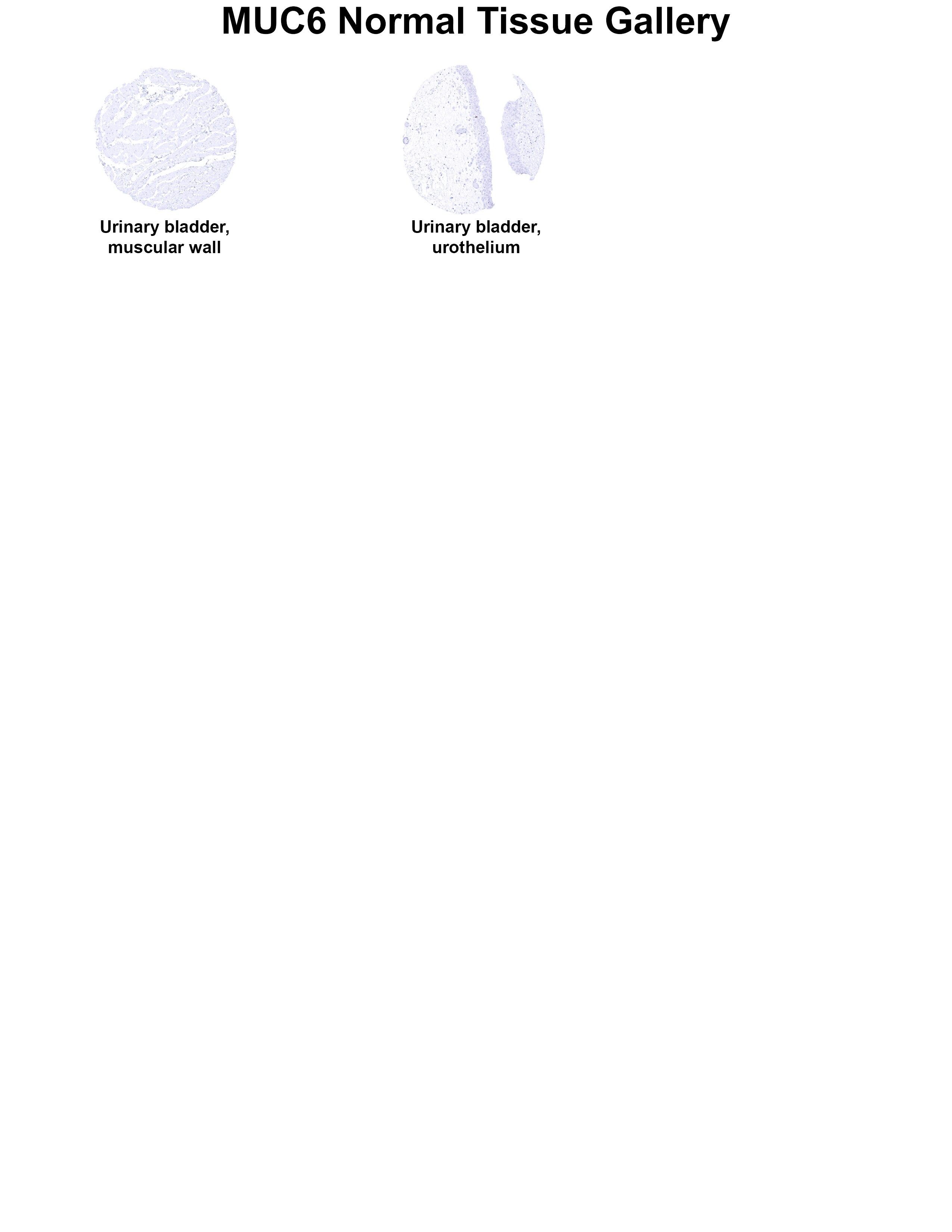 MUC6 Antibody (MSVA-806R) - Azide and BSA Free MUC6 Antibody (MSVA-806R) - Azide and BSA Free MUC6 Normal Tissue Gallery