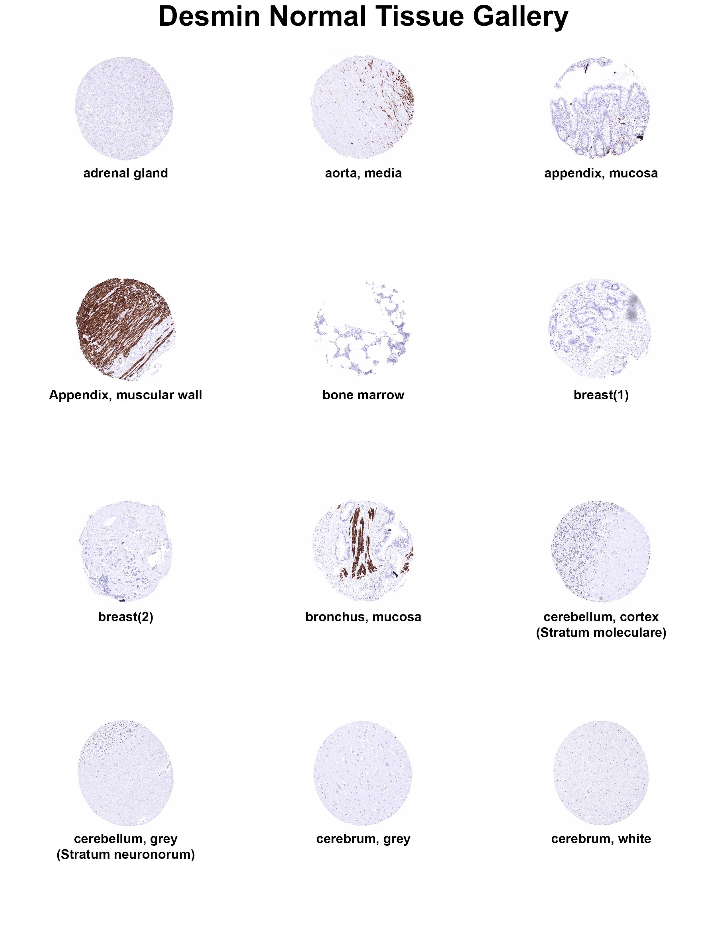 Desmin Antibody (MSVA-651M) - Azide and BSA Free Desmin Antibody (MSVA-651M) - Azide and BSA Free Desmin Normal Tissue Gallery