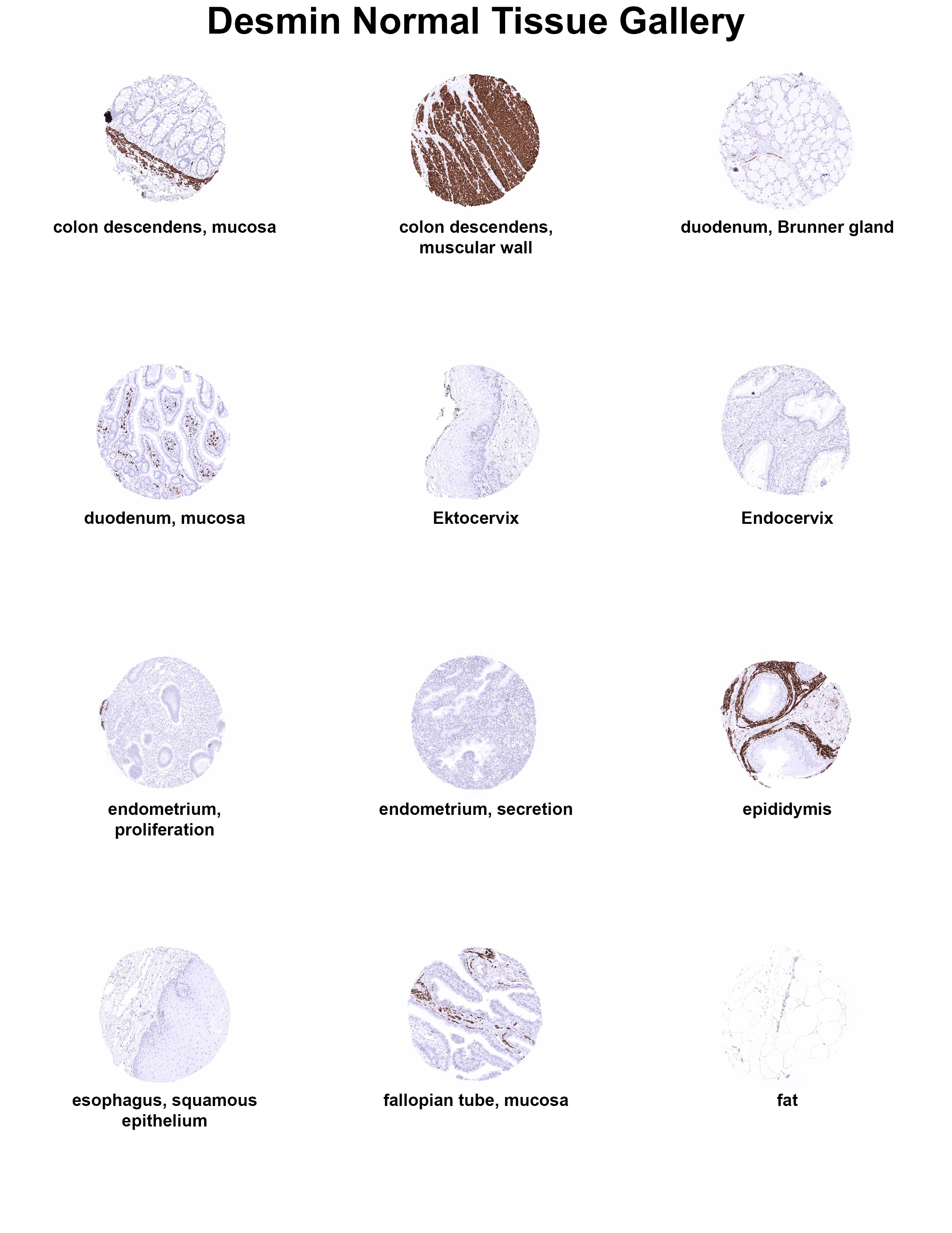 Desmin Antibody (MSVA-651M) - Azide and BSA Free Desmin Antibody (MSVA-651M) - Azide and BSA Free Desmin Normal Tissue Gallery