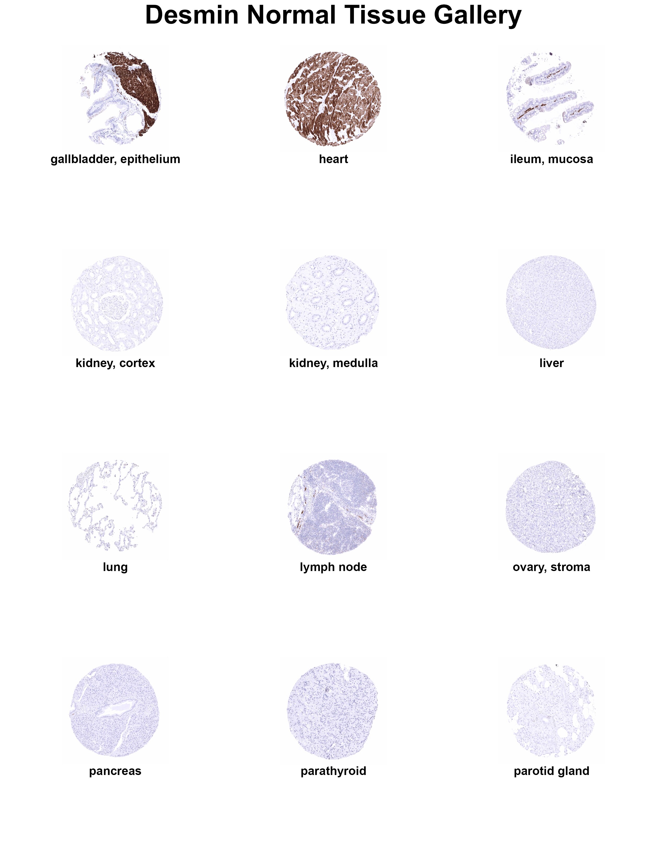 Desmin Antibody (MSVA-651M) - Azide and BSA Free Desmin Antibody (MSVA-651M) - Azide and BSA Free Desmin Normal Tissue Gallery