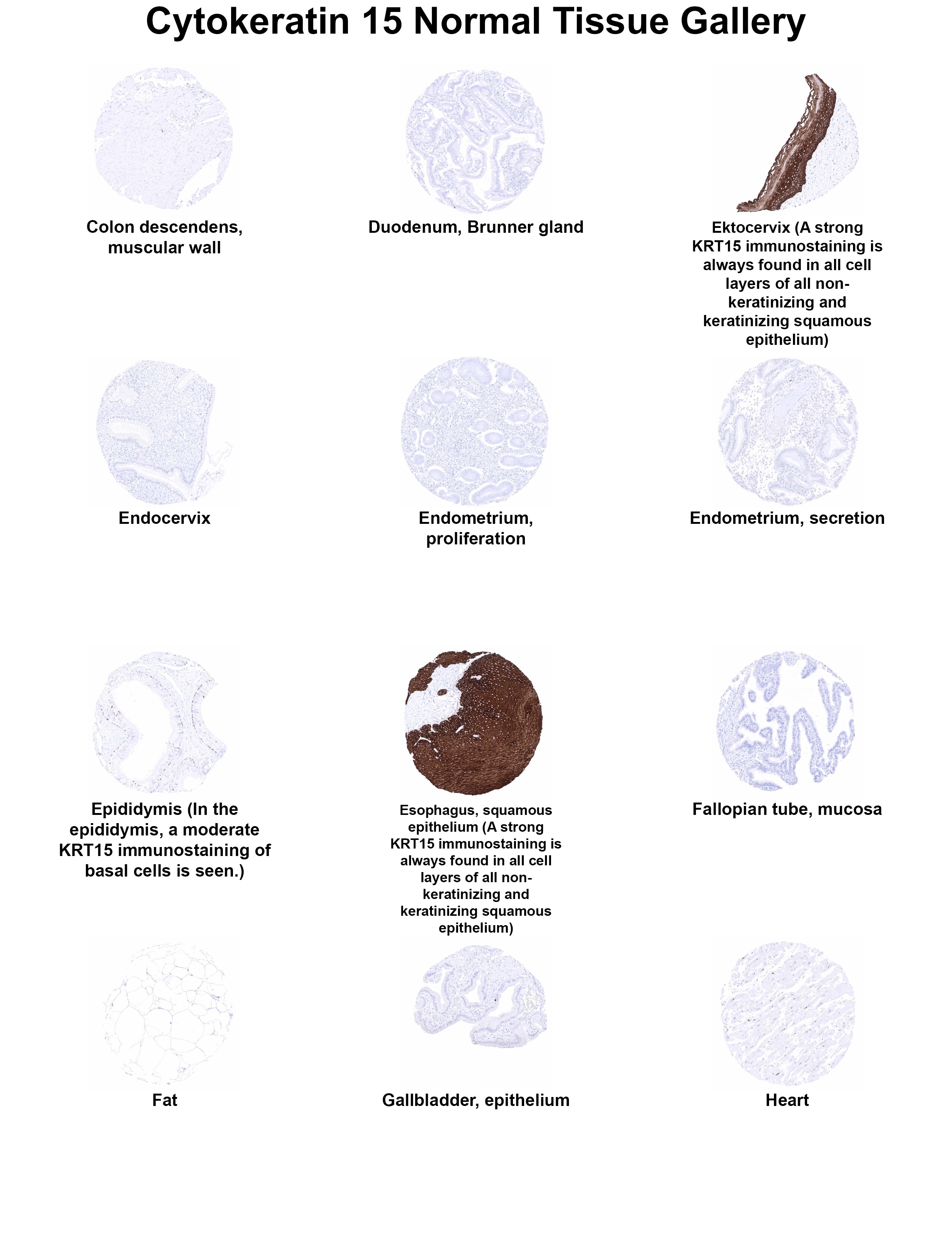 Cytokeratin 15 Antibody (MSVA-615M) - Azide and BSA Free Cytokeratin 15 Antibody (MSVA-615M) - Azide and BSA Free Cytokeratin 15 Normal Tissue Gallery