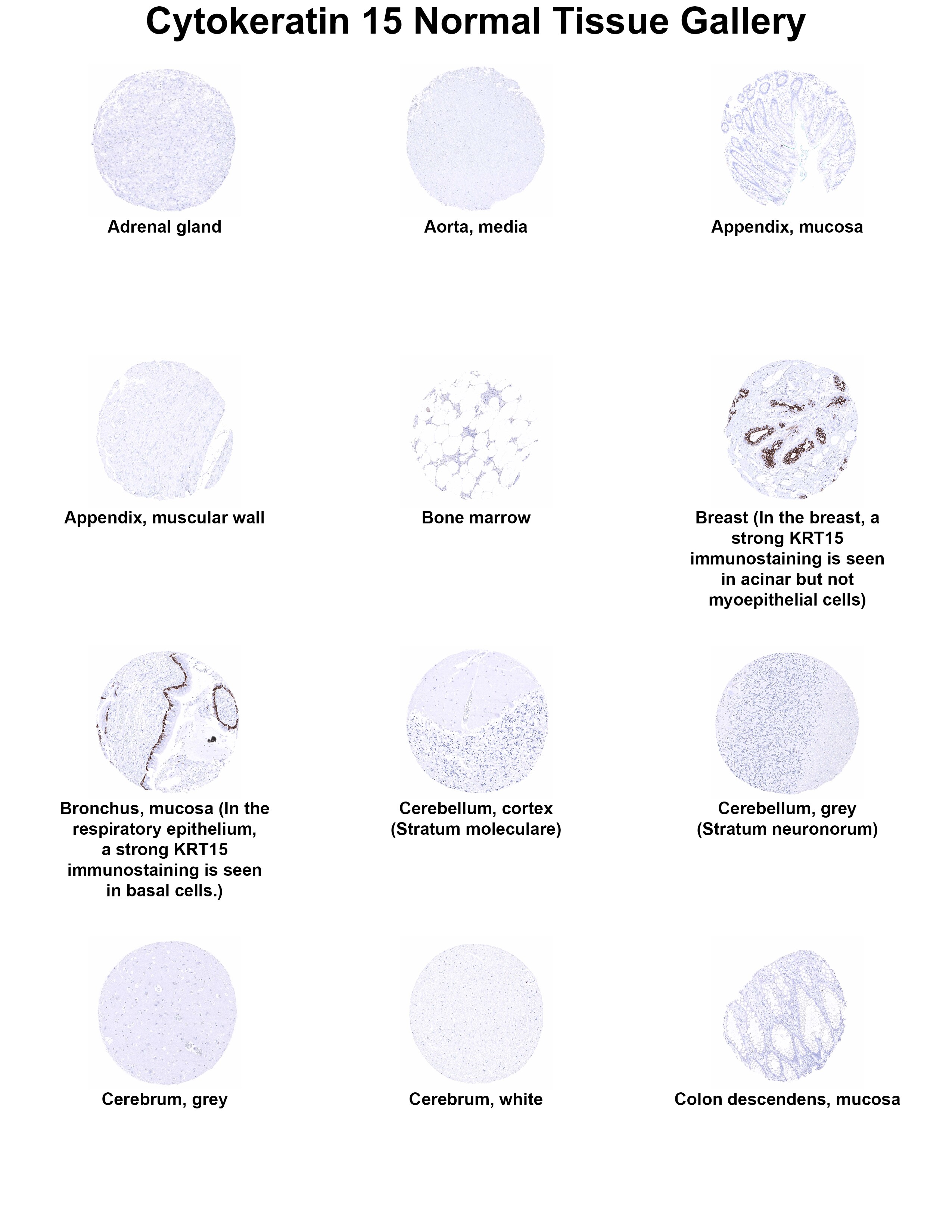 Cytokeratin 15 Antibody (MSVA-615M) - Azide and BSA Free Cytokeratin 15 Antibody (MSVA-615M) - Azide and BSA Free Cytokeratin 15 Normal Tissue Gallery
