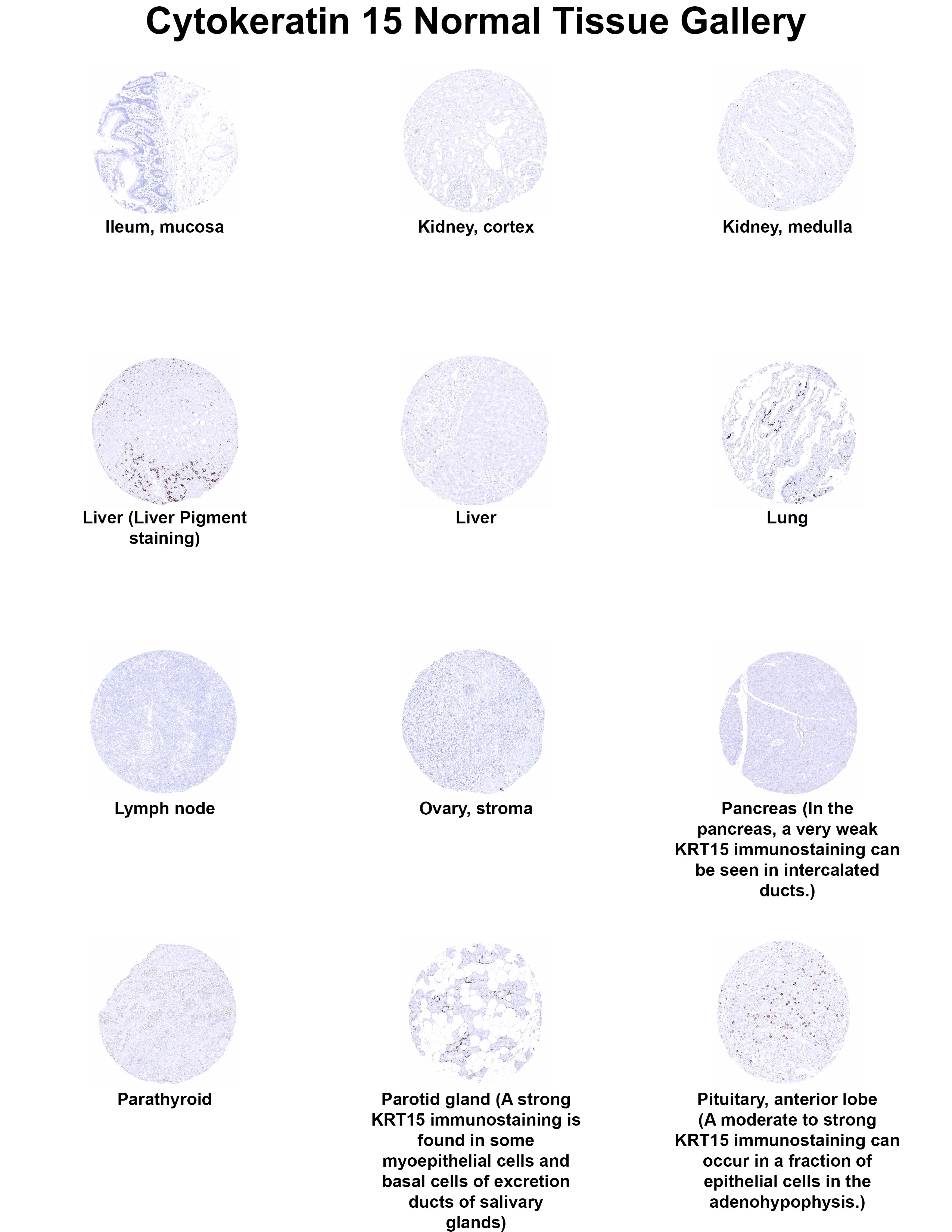 Cytokeratin 15 Antibody (MSVA-615M) - Azide and BSA Free Cytokeratin 15 Antibody (MSVA-615M) - Azide and BSA Free Cytokeratin 15 Normal Tissue Gallery
