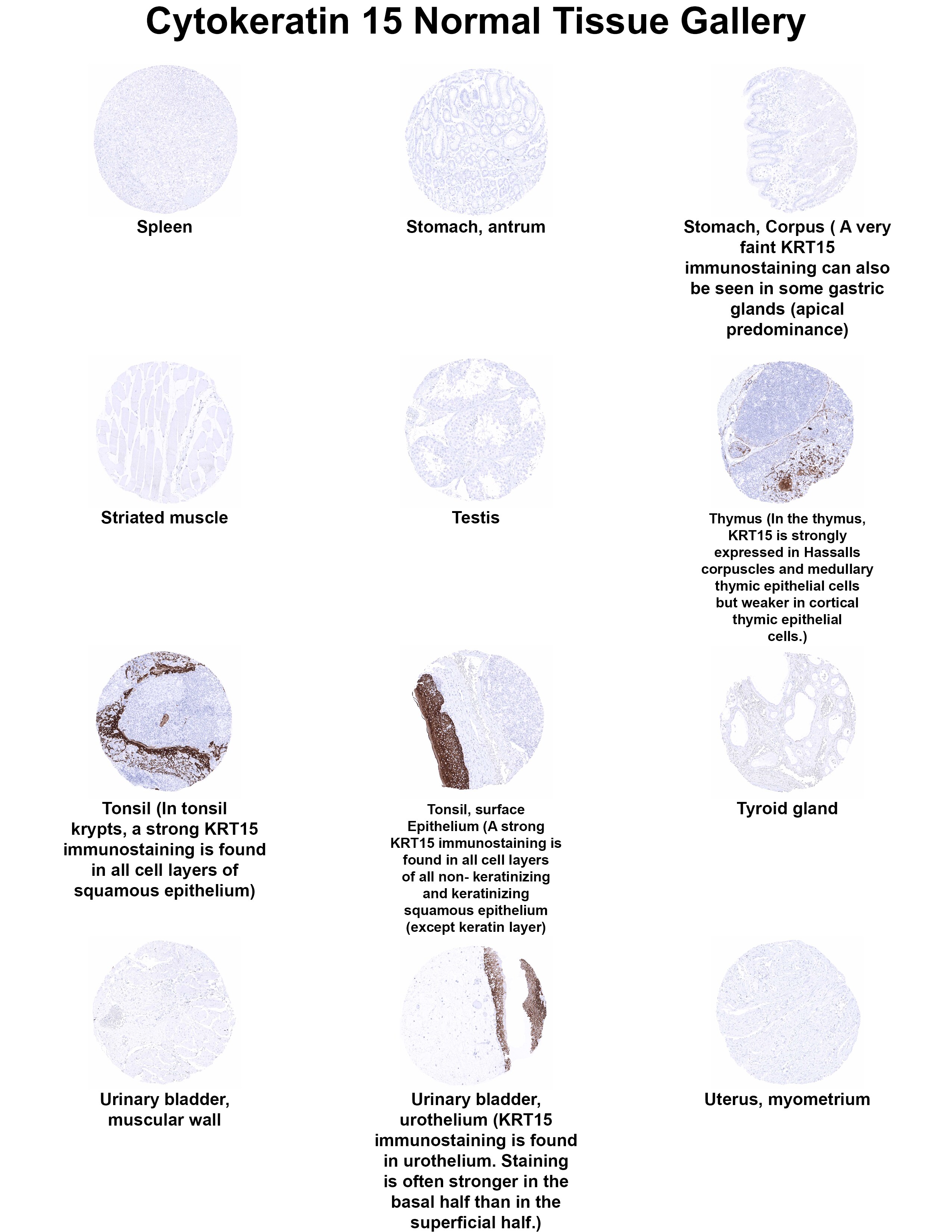 Cytokeratin 15 Antibody (MSVA-615M) - Azide and BSA Free Cytokeratin 15 Antibody (MSVA-615M) - Azide and BSA Free Cytokeratin 15 Normal Tissue Gallery
