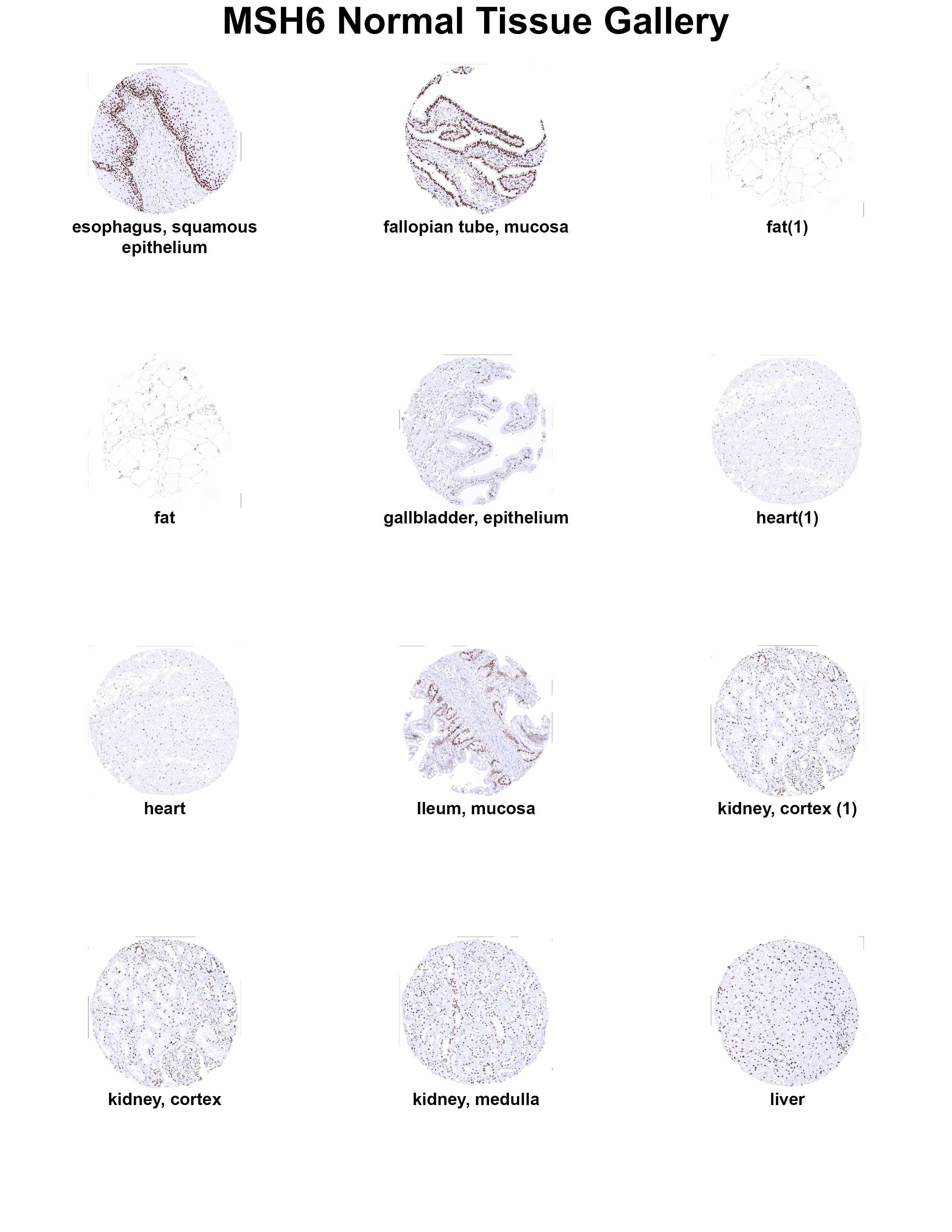 MSH6 Antibody (MSVA-906R) - Azide and BSA Free MSH6 Antibody (MSVA-906R) - Azide and BSA Free MSH6 Normal Tissue Gallery