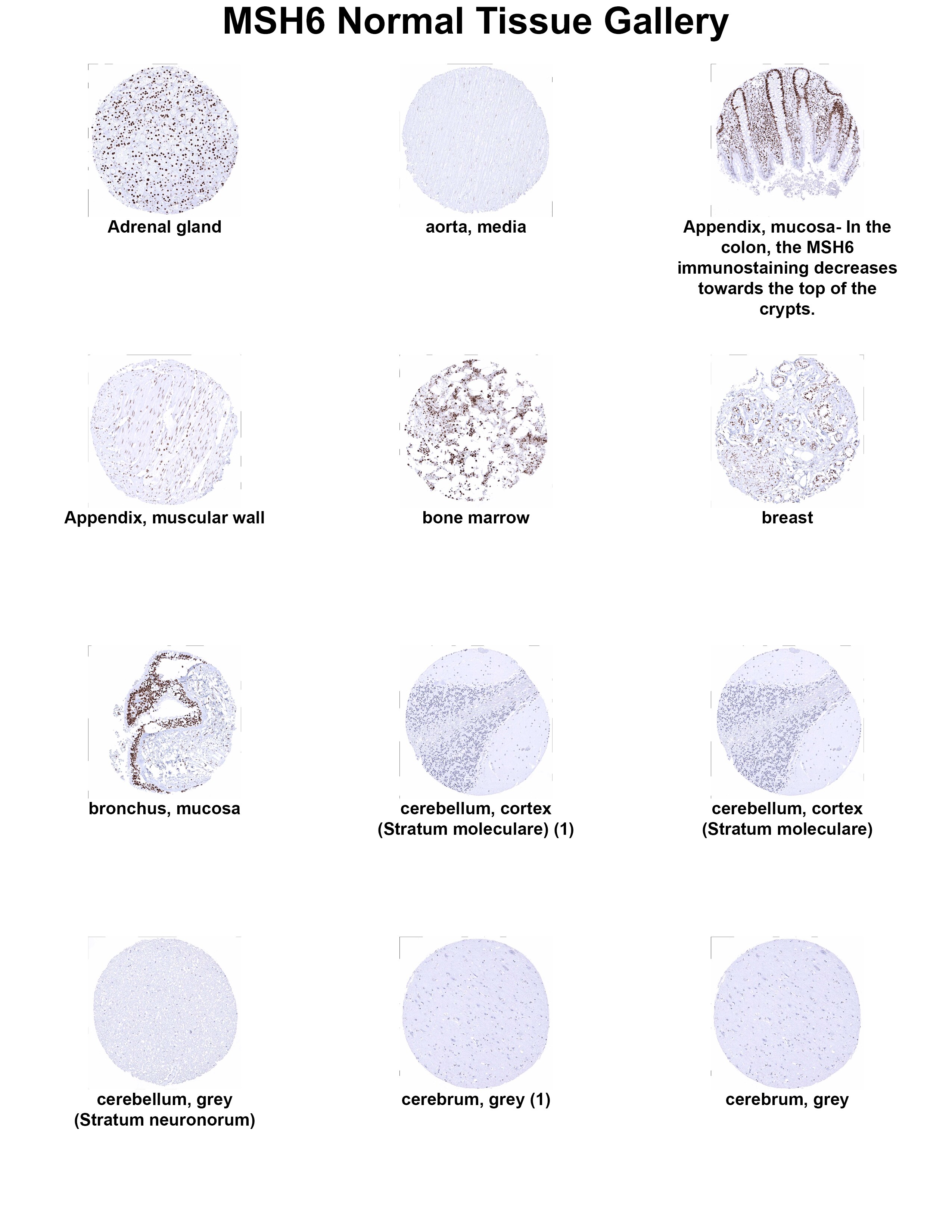 MSH6 Antibody (MSVA-906R) - Azide and BSA Free MSH6 Antibody (MSVA-906R) - Azide and BSA Free MSH6 Normal Tissue Gallery