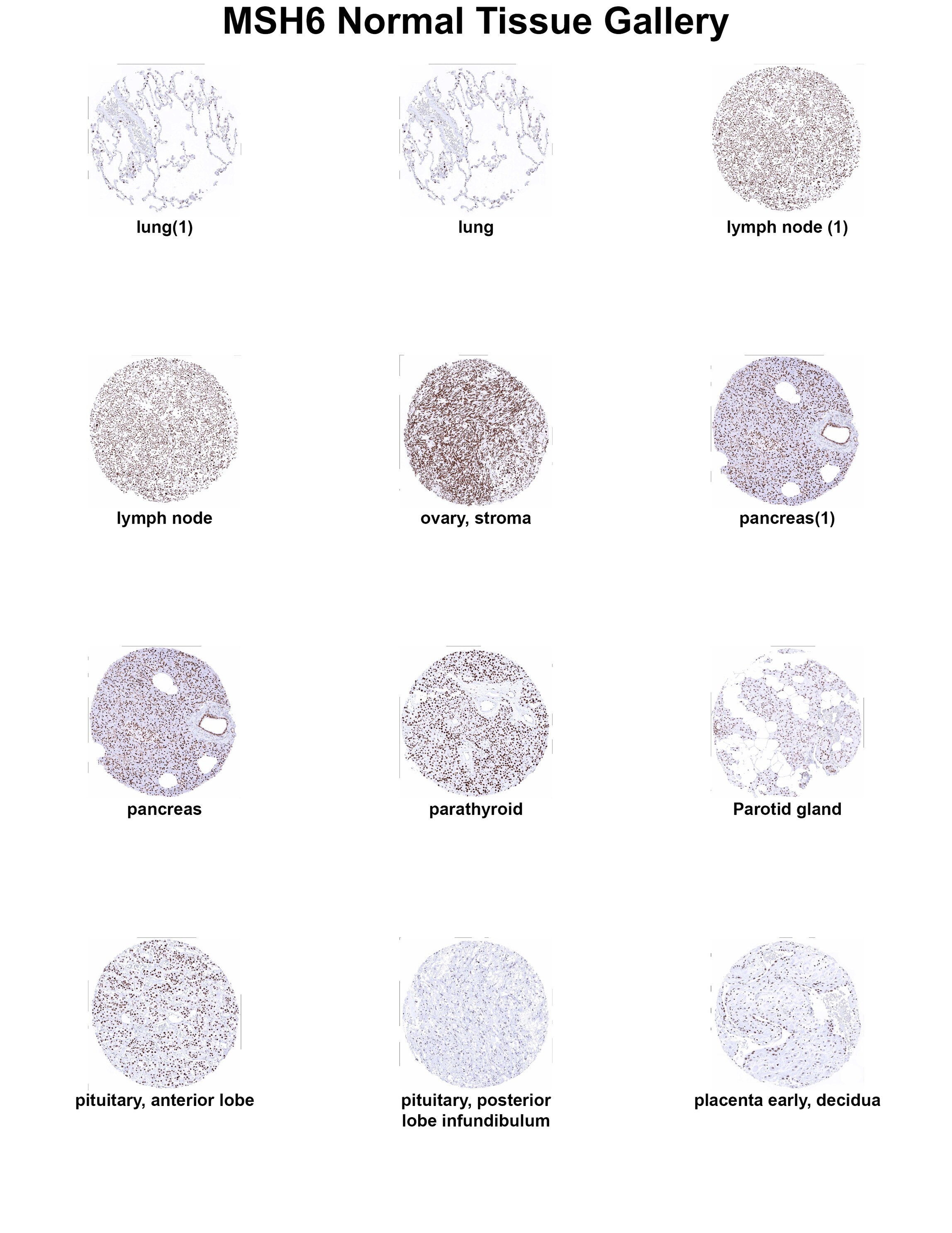 MSH6 Antibody (MSVA-906R) - Azide and BSA Free MSH6 Antibody (MSVA-906R) - Azide and BSA Free MSH6 Normal Tissue Gallery