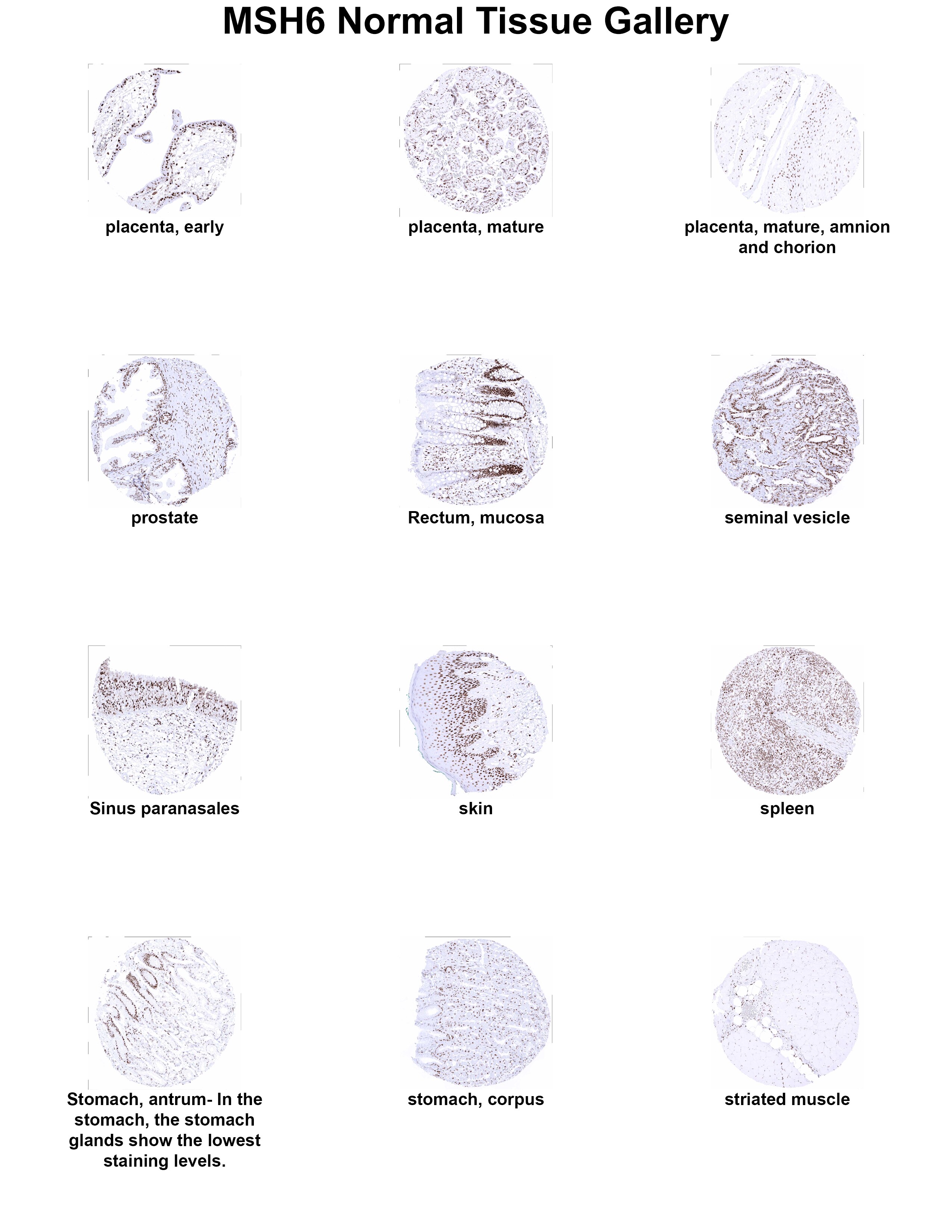 MSH6 Antibody (MSVA-906R) - Azide and BSA Free MSH6 Antibody (MSVA-906R) - Azide and BSA Free MSH6 Normal Tissue Gallery