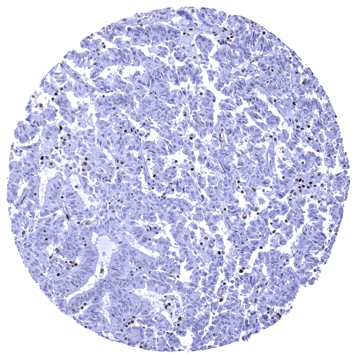 MSH6 Antibody (MSVA-906R) - Azide and BSA Free