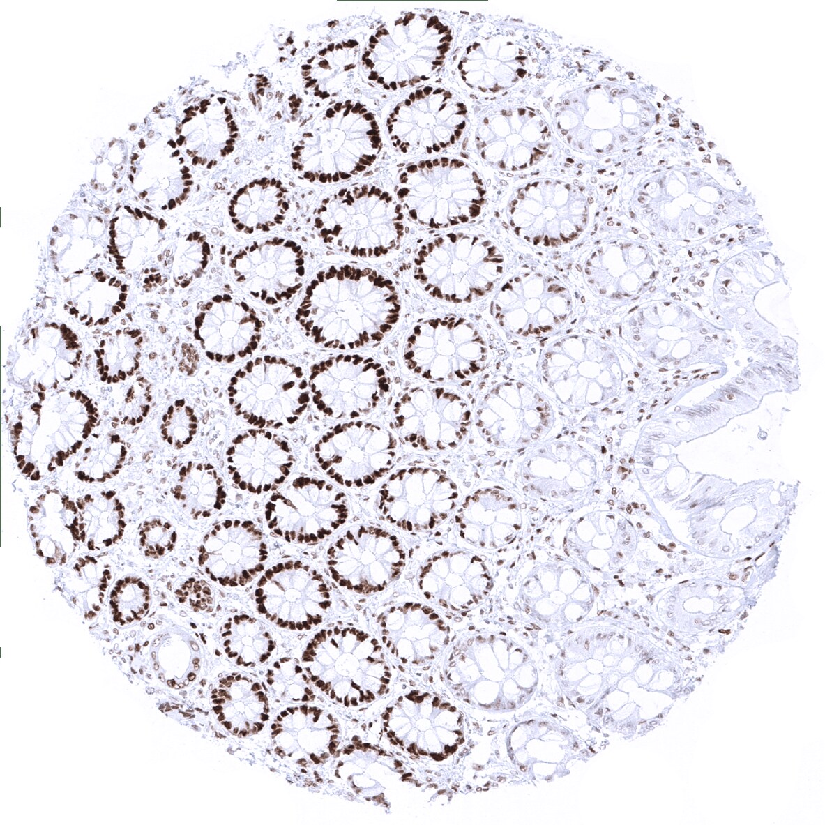MSH6 Antibody (MSVA-906R) - Azide and BSA Free