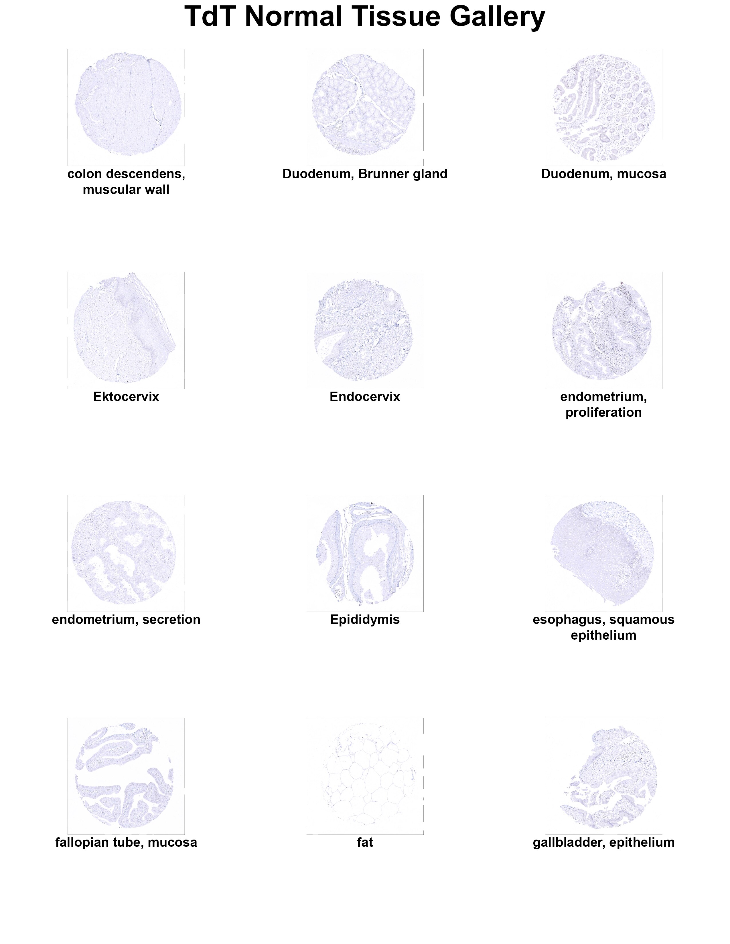 TdT Antibody (MSVA-453R) - Azide and BSA Free TdT Antibody (MSVA-453R) - Azide and BSA Free TdT Normal Tissue Gallery