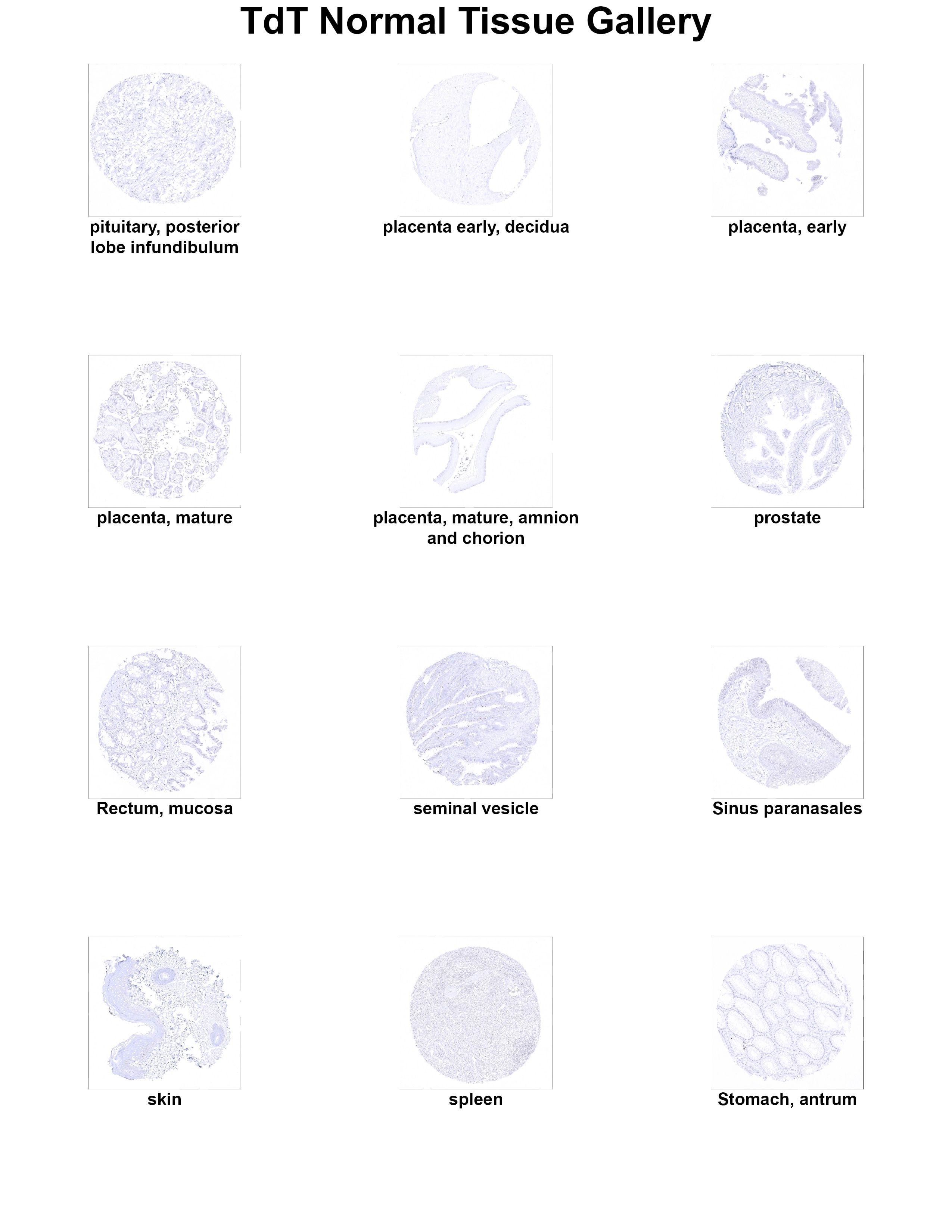 TdT Antibody (MSVA-453R) - Azide and BSA Free TdT Antibody (MSVA-453R) - Azide and BSA Free TdT Normal Tissue Gallery