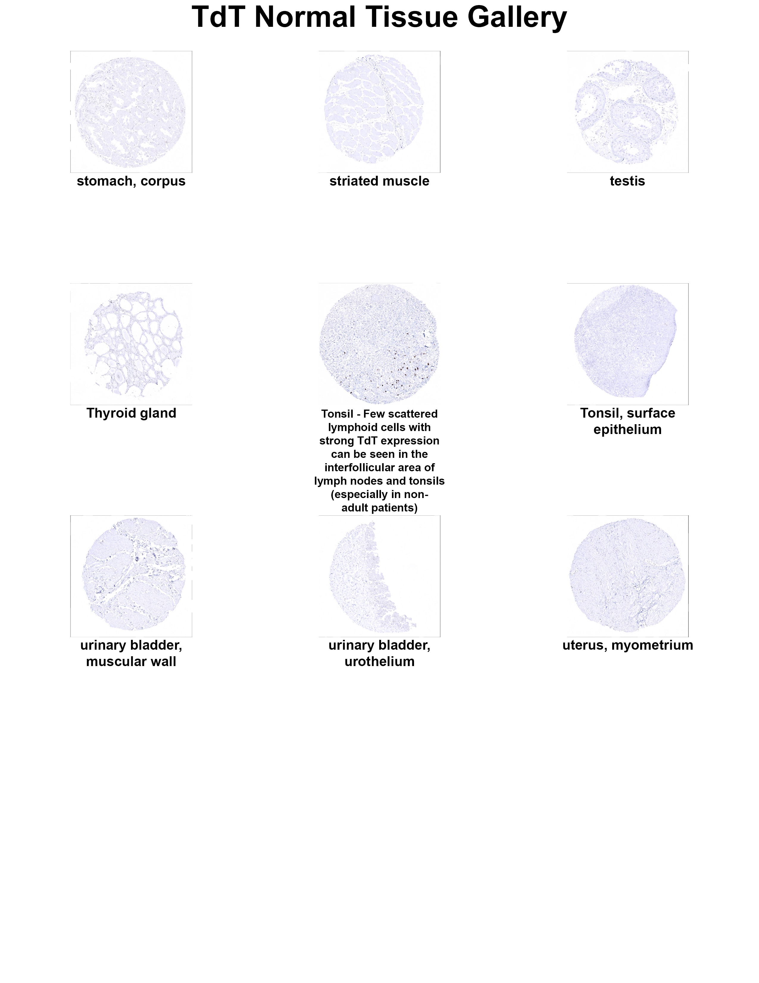 TdT Antibody (MSVA-453R) - Azide and BSA Free TdT Antibody (MSVA-453R) - Azide and BSA Free TdT Normal Tissue Gallery