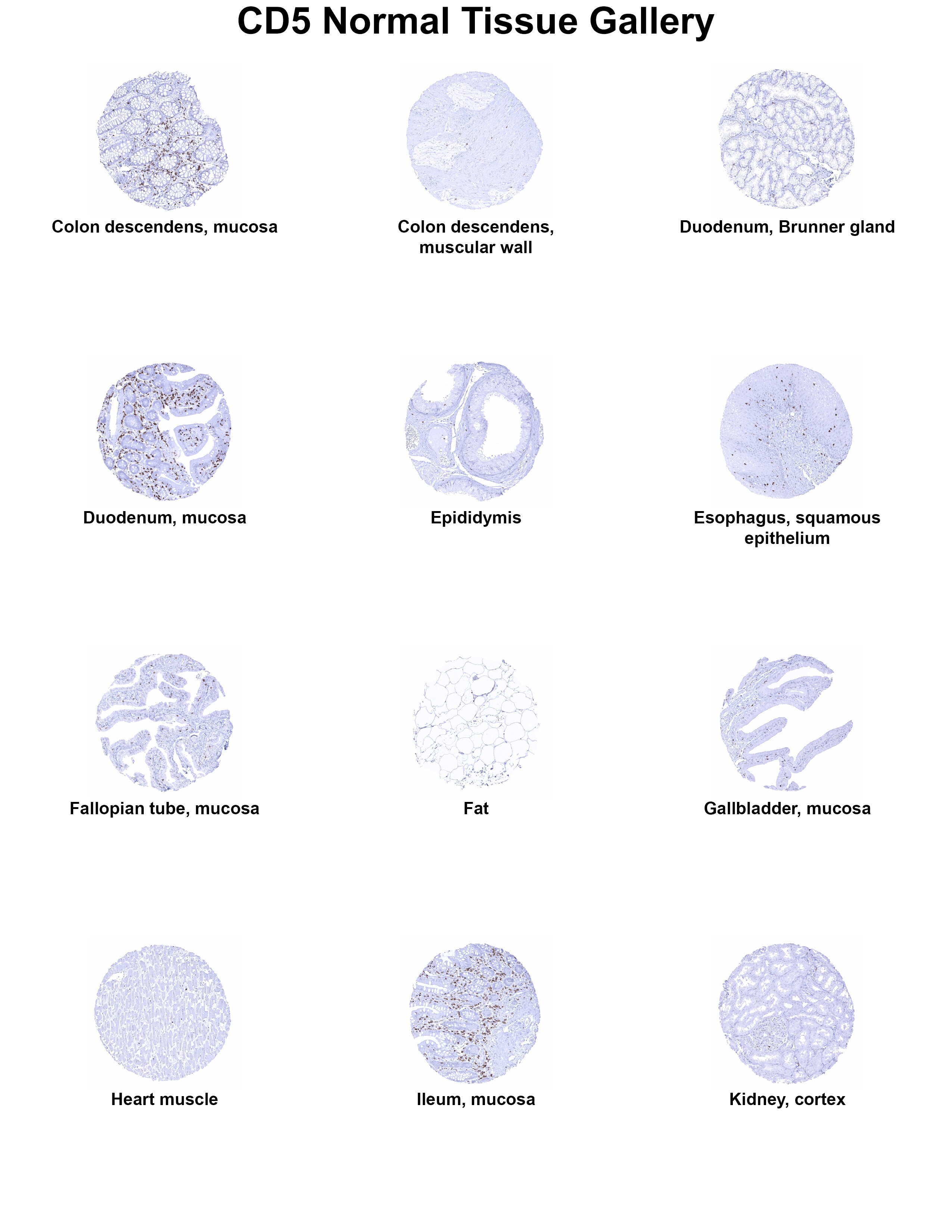 CD5 Antibody (MSVA-005R) - Azide and BSA Free CD5 Antibody (MSVA-005R) - Azide and BSA Free CD5 Normal Tissue Gallery