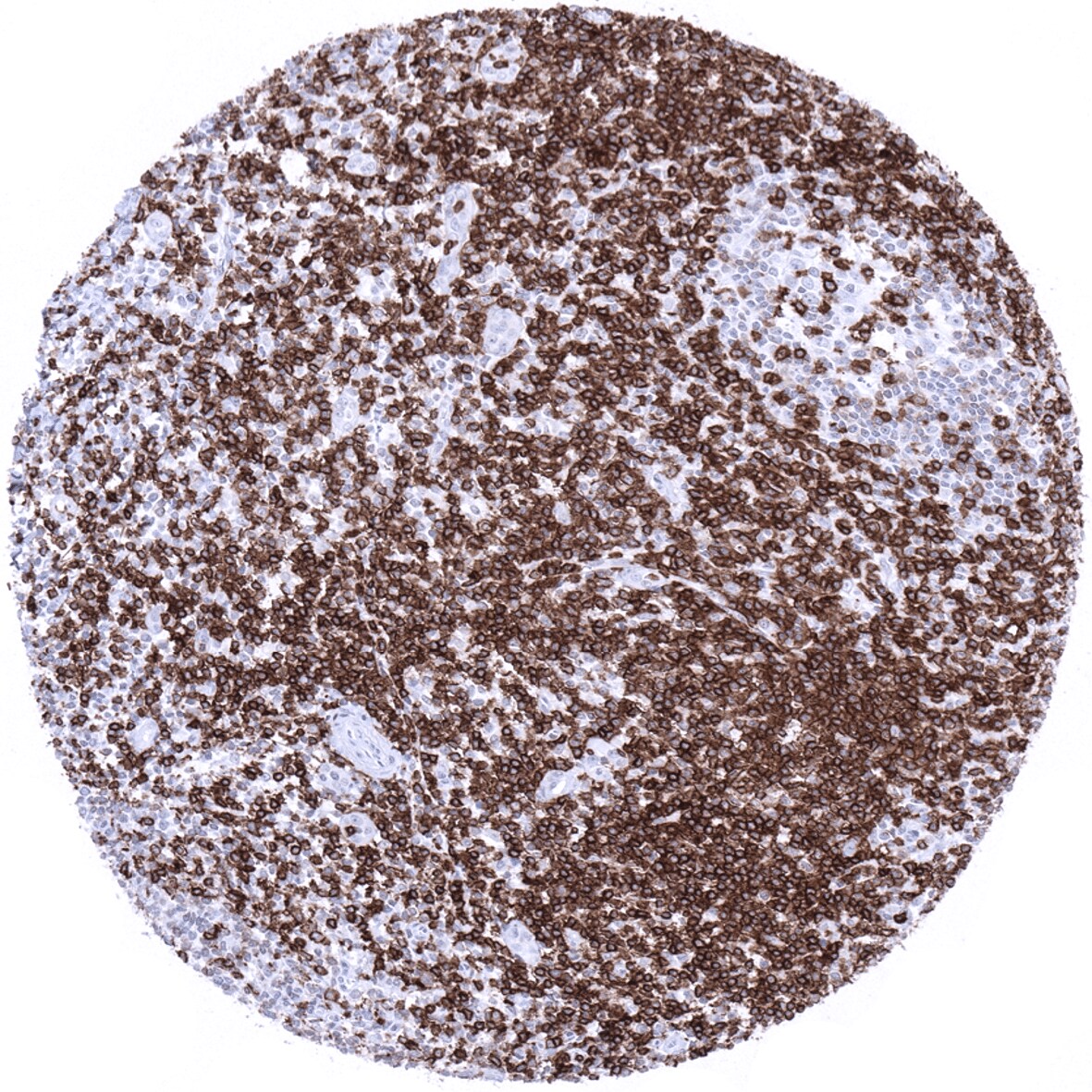 CD5 Antibody (MSVA-005R) - Azide and BSA Free