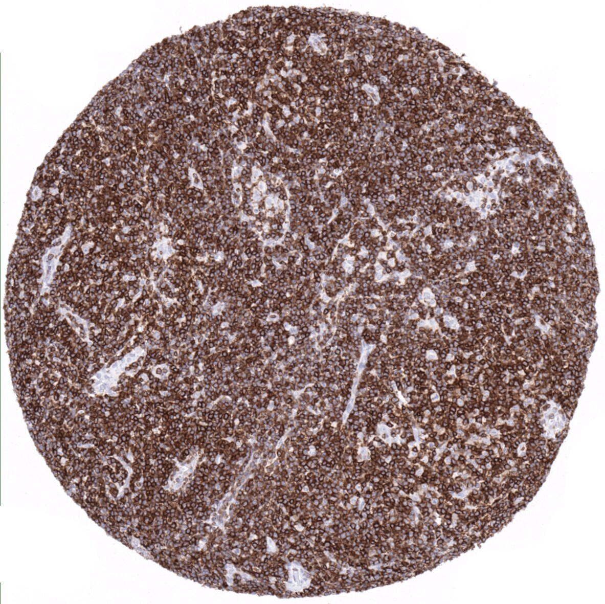 CD5 Antibody (MSVA-005R) - Azide and BSA Free