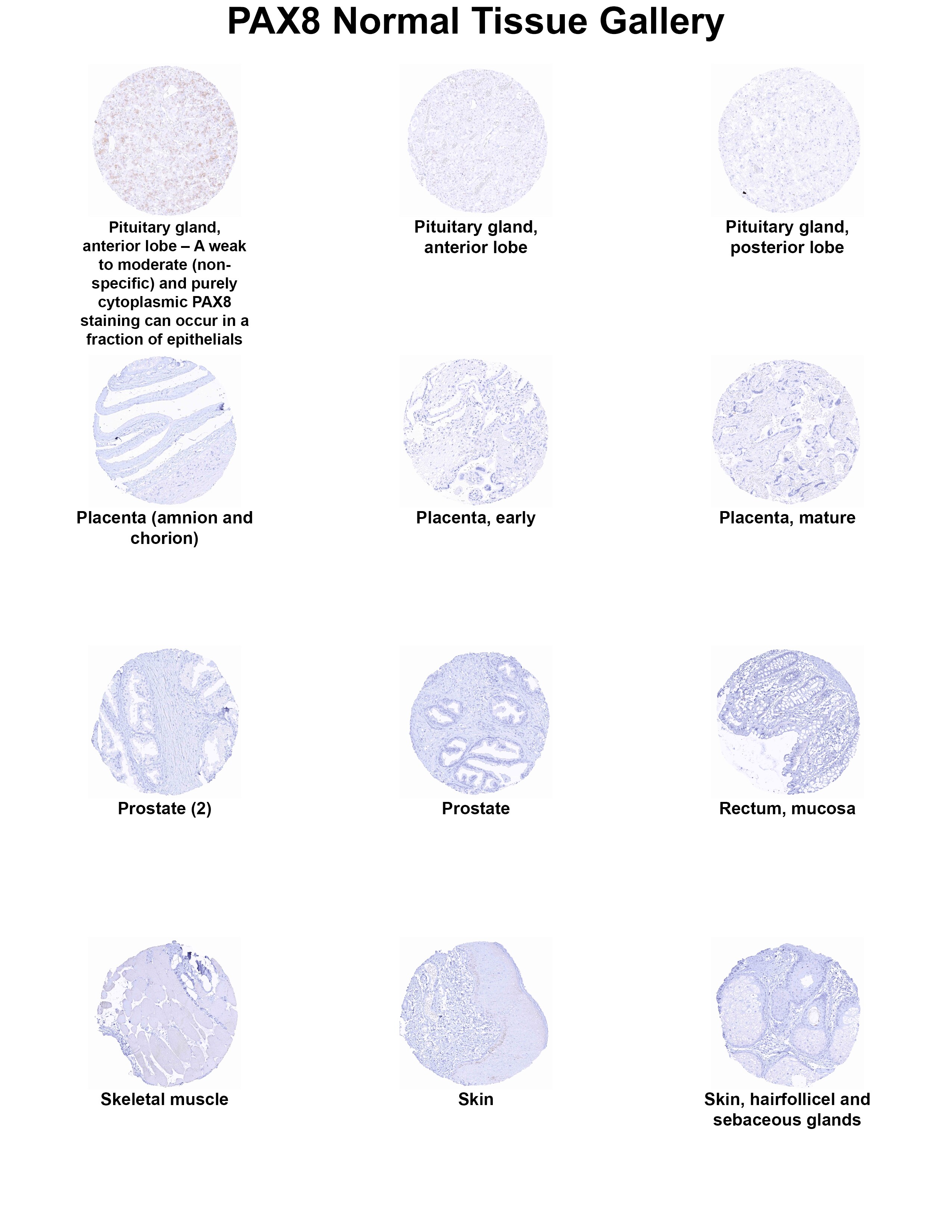 PAX8 Antibody (MSVA-708R) - Azide and BSA Free PAX8 Antibody (MSVA-708R) - Azide and BSA Free PAX8 Normal Tissue Gallery